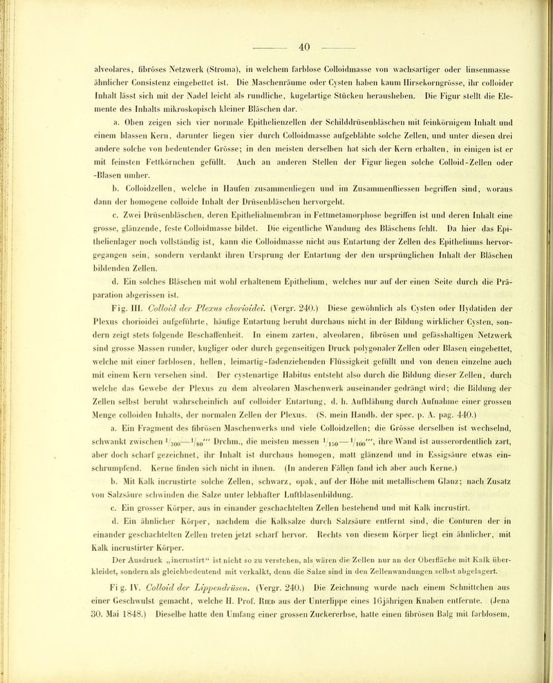 ähnlicher Consistenz eingebettet ist. Die Maschenräume oder Cysten haben kaum Hirsekorngrösse, ihr colloider Inhalt lässt sich mit der Nadel leicht als rundliche, kugelartige Stücken herausheben. Die Figur stellt die Ele- mente des Inhalts mikroskopisch kleiner Bläschen dar. a. Oben zeigen sich vier normale Epithelienzellen der Schilddrüsenbläschen mit feinkörnigem Inhalt und einem blassen Kern, darunter liegen vier durch Colloidmasse aufgeblähte solche Zellen, und unter diesen drei andere solche von bedeutender Grösse; in den meisten derselben hat sich der Kern erhalten, in einigen ist er mit feinsten Fettkörnchen gefüllt. Auch an anderen Stellen der Figur liegen solche Colloid-Zellen oder -Blasen umher. b. Colloidzellen, welche in Haufen zusammenliegen und im Zusammenfliessen begriffen sind, woraus dann der homogene colloide Inhalt der Drüsenbläschen hervorgeht. c. Zwei Drüsenbläschen, deren Epithelialmembran in Fettmetamorphose begriffen ist und deren Inhalt eine grosse, glänzende, feste Colloidmasse bildet. Die eigentliche Wandung des Bläschens fehlt. Da hier das Epi- thelienlager noch vollständig ist, kann die Colloidmasse nicht aus Entartung der Zellen des Epitheliums hervor- gegangen sein, sondern verdankt ihren Ursprung der Entartung der den ursprünglichen Inhalt der Bläschen bildenden Zellen. d. Ein solches Bläschen mit wohl erhaltenem Epithelium, welches nur auf der einen Seite durch die Prä- paration abgerissen ist. Fig. III. Colloid der Plexus chorioidei. (Vergr. 240.) Diese gewöhnlich als Cysten oder Hydatiden der Plexus chorioidei aufgeführte, häufige Entartung beruht durchaus nicht in der Bildung wirklicher Cysten, son- dern zeigt stets folgende Beschaffenheit. In einem zarten, alveolaren, fibrösen und gefässhaltigen Netzwerk sind grosse Massen runder, kugliger oder durch gegenseitigen Druck polygonaler Zellen oder Blasen eingebettet, welche mit einer farblosen, hellen, leimartig-fadenziehenden Flüssigkeit gefüllt und von denen einzelne auch mit einem Kern versehen sind. Der cystenartige Habitus entsteht also durch die Bildung dieser Zellen, durch welche das Gewebe der Plexus zu dem alveolaren Maschenwerk auseinander gedrängt wird; die Bildung der Zellen selbst beruht wahrscheinlich auf colloider Entartung, d. b. Aufblähung durch Aufnahme einer grossen Menge colloiden Inhalts, der normalen Zellen der Plexus. (S. mein Handb. der spec. p. A. pag. 440.) a. Ein Fragment des fibrösen Maschenwerks und viele Colloidzellen; die Grösse derselben ist wechselnd, schwankt zwischen ( 300—1/80/ Drchm., die meisten messen l/150 — 1/i00', ihre Wand ist ausserordentlich zart, aber doch scharf gezeichnet, ihr Inhalt ist durchaus homogen, matt glänzend und in Essigsäure etwas ein- schrumpfend. Kerne finden sich nicht in ihnen. (In anderen Fällen fand ich aber auch Kerne.) b. Mit Kalk incrustirte solche Zellen, schwarz, opak, auf der Höhe mit metallischem Glanz; nach Zusatz von Salzsäure schwinden die Salze unter lebhafter Luftblasenbildung. c. Ein grosser Körper, aus in einander geschachtelten Zellen bestehend und mit Kalk incrustirt. d. Ein ähnlicher Körper, nachdem die Kalksalze durch Salzsäure entfernt sind, die Conturen der in einander geschachtelten Zellen treten jetzt scharf hervor. Rechts von diesem Körper liegt ein ähnlicher, mit Kalk incrustirter Körper. Der Ausdruck „incrustirt“ ist nicht so zu verstehen, als wären die Zellen nur an der Oberfläche mit Kalk über- kleidet, sondern als gleichbedeutend mit verkalkt, denn die Salze sind in den Zellenwandungen selbst abgelagert. Fi g. IV. Colloid der Lippendrüsen. (Vergr. 240.) Die Zeichnung wurde nach einem Schnittchen aus einer Geschwulst gemacht, welche H. Prof. Ried aus der Unterlippe eines 16jährigen Knaben entfernte. (Jena 30. Mai 1848.) Dieselbe hatte den Umfang einer grossen Zuckererbse, hatte einen fibrösen Balg mit farblosem,