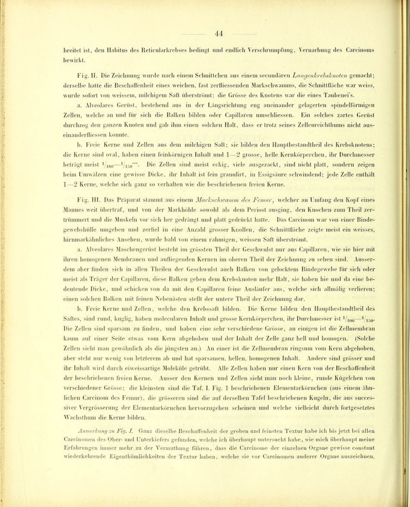 breitet ist, den Habitus des Reticularkrebses bedingt und endlich Verschrumpfung, Vernarbung des Carcinoms bewirkt. Fig. II. Die Zeichnung wurde nach einem Schnittchen aus einem secundiiren Lungenkrebsknoten gemacht; derselbe hatte die Beschaffenheit eines weichen, fast zerfliessenden Markschwamms, die Schnittfläche war weiss, wurde sofort von weisscm, milchigem Saft überströmt; die Grösse des Knotens war die eines Taubenei’s. a. Alveolares Gerüst, bestehend aus in der Längsrichtung eng aneinander gelagerten spindelförmigen Zellen, welche an und für sich die Balken bilden oder Capillaren umschliessen. Ein solches zartes Gerüst durchzog den ganzen Knoten und gab ihm einen solchen Halt, dass ertrotz seines Zellenreichthums nicht aus- einanderfliessen konnte. b. Freie Kerne und Zellen aus dem milchigen Saft; sie bilden den Hauptbestandtheil des Krebsknotens; die Kerne sind oval, haben einen feinkörnigen Inhalt und 1—2 grosse, helle Kernkörperchen, ihr Durchmesser beträgt meist l/1S0—Die Zellen sind meist eckig, viele ausgezackt, sind nicht platt, sondern zeigen beim Umwälzen eine gewisse Dicke, ihr Inhalt ist fein granulirt, in Essigsäure schwindend; jede Zelle enthält 1—2 Kerne, welche sich ganz so verhalten wie die beschriebenen freien Kerne. Fig. 111. D as Präparat stammt aus einem Markschwamm des Femur, welcher an Umfang den Kopf eines Mannes weit übertraf, und von der Markhöhle sowohl als dem Periost ausging, den Knochen zum Theil zer- trümmert und die Muskeln vor sich her gedrängt und platt gedrückt hatte. Das Carcinom war von einer Binde- gewebshülle umgeben und zerfiel in eine Anzahl grosser Knollen, die Schnittfläche zeigte meist ein weisses, hirnmarkähnliches Ansehen, wurde bald von einem rahmigen, weissen Salt überströmt. a. Alveolares Maschengerüst besteht im grössten Theil der Geschwulst nur aus Capillaren, wie sie hier mit ihren homogenen Membranen und aufliegenden Kernen im oberen Theil der Zeichnung zu sehen sind. Ausser- dem aber finden sich in allen Theilen der Geschwulst auch Balken von gelocktem Bindegewebe für sich oder meist als Träger der Capillaren, diese Balken geben dem Krebsknoten mehr Halt, sic haben hie und da eine be- deutende Dicke, und schicken von da mit den Capillaren feine Ausläufer aus, welche sich allmälig verlieren; einen solchen Balken mit feinen Nebenästen stellt der untere Theil der Zeichnung dar. b. Freie Kerne und Zellen, welche den Krebssaft bilden. Die Kerne bilden den Hauptbestandteil des Saftes, sind rund, kuglig, haben molecularen Inhalt und grosse Kernkörperchen, ihr Durchmesser ist 1/200—*/150. Die Zellen sind sparsam zu finden, und haben eine sehr verschiedene Grösse, an einigen ist die Zellmembran kaum auf einer Seite etwas vom Kern abgehoben und der Inhalt der Zelle ganz hell und homogen. (Solche Zellen sieht man gewöhnlich als die jüngsten an.) An einer ist die Zellmembran ringsum vom Kern abgehoben, aber steht nur wenig von letzterem ab und hat sparsamen, hellen, homogenen Inhalt. Andere sind grösser und ihr Inhalt wird durch eiweissartige Moleküle getrübt. Alle Zellen halten nur einen Kern von der Beschaffenheit der beschriebenen freien Kerne. Ausser den Kernen und Zellen sieht man noch kleine, runde Kügelchen von verschiedener Grösse; die kleinsten sind die Taf. I. Fig. 1 beschriebenen Elementarkörnchen (aus einem ähn- lichen Carcinom des Femur), die grösseren sind die auf derselben Tafel beschriebenen Kugeln, die aus succes- siver Vergrösserung der Elementarkörnchen hervorzugehen scheinen und welche vielleicht durch fortgesetztes Wachsthum die Kerne bilden. Anmerkung zu Fig. I. Ganz dieselbe Beschaffenheit der groben und feinsten Textur habe ich bis jetzt bei allen Carcinomen des Ober- und Unterkiefers gefunden, welche ich überhaupt untersucht habe, wie mich überhaupt meine Erfahrungen immer mehr zu der Vermuthung führen, dass die Carcinome der einzelnen Organe gewisse constant wiederkehrende Eigenthümlichkeiten der Textur haben, welche sie vor Carcinomen anderer Organe auszeichnen.