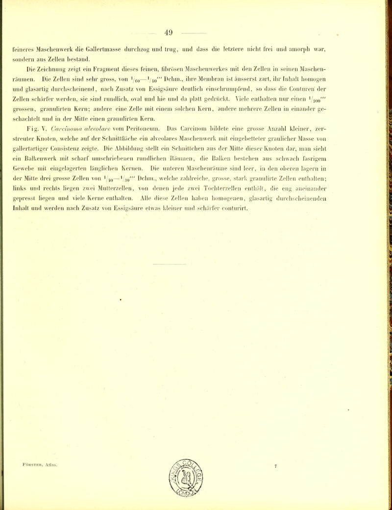 feineres Maschenwerk die Gallertmasse durchzog und trug, und dass die letztere nicht frei und amorph war, sondern aus Zellen bestand. Die Zeichnung zeigt ein Fragment dieses feinen, fibrösen Maschenwerkes mit den Zellen in seinen Maschen- räumen. Die Zellen sind sehr gross, von 1/60—1/40'“ Dehrn., ihre Membran ist äusserst zart, ihr Inhalt homogen und glasartig durchscheinend, nach Zusatz von Essigsäure deutlich einschrumpfend, so dass die Conturen der Zellen schärfer werden, sie sind rundlich, oval und hie und da platt gedrückt. Viele enthalten nur einen 1/-2oo“ grossen, granulirten Kern; andere eine Zelle mit einem solchen Kern, andere mehrere Zellen in einander ge- schachtelt und in der Mitte einen granulirten Kern. Fig. V. Carcinoma alveolare vom Peritoneum. Das Carcinom bildete eine grosse Anzahl kleiner, zer- streuter Knoten, welche auf der Schnittfläche ein alveolares Maschenwerk mit eingebetteter graulicher Masse von gallertartiger Consistenz zeigte. Die Abbildung stellt ein Schnittchen aus der Mitte dieser Knoten dar, man sieht ein Balkenwerk mit scharf umschriebenen rundlichen Räumen, die Balken bestehen aus schwach fasrigem Gewebe mit eingelagerten länglichen Kernen. Die unteren Maschenräume sind leer, in den oberen lagern in der Mitte drei grosse Zellen von 1/40—1 30' Dehrn., welche zahlreiche, grosse, stark granulirte Zellen enthalten; links und rechts liegen zwei Mutterzellen, von denen jede zwei Tochterzellen enthält, die eng aneinander gepresst liegen und viele Kerne enthalten. Alle diese Zellen haben homogenen, glasartig durchscheinenden Inhalt und werden nach Zusatz von Essigsäure etwas kleiner und schärfer conturirt. Förster, Atlas.