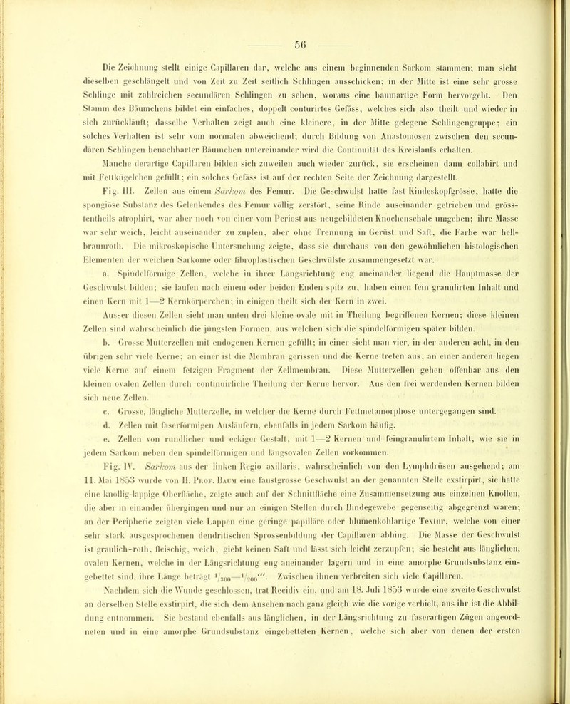 Die Zeichnung stellt einige Capillaren dar, welche aus einem beginnenden Sarkom stammen; man sieht dieselben geschlängelt und von Zeit zu Zeit seitlich Schlingen ausschicken; in der Mitte ist eine sehr grosse Schlinge mit zahlreichen secundären Schlingen zu sehen, woraus eine baumartige Form hervorgeht. Den Stamm des Bäumchens bildet ein einfaches, doppelt conturirtes Gefäss, welches sich also theilt und wieder in sich zurückläuft; dasselbe Verhalten zeigt auch eine kleinere, in der Mitte gelegene Schlingengruppe; ein solches Verhalten ist sehr vom normalen abweichend; durch Bildung von Anastomosen zwischen den secun- dären Schlingen benachbarter Bäumchen untereinander wird die Continuität des Kreislaufs erhalten. Manche derartige Capillaren bilden sich zuweilen auch wieder zurück, sie erscheinen dann collabirt und mit Fettkügelchen gefüllt; ein solches Gefäss ist auf der rechten Seile der Zeichnung dargestellt. Fig. 111. Zellen aus einem Sarkom des Femur. Die Geschwulst hatte fast Kindeskopfgrösse, hatte die spongiöse Substanz des Gelenkendes des Femur völlig zerstört, seine Rinde auseinander getrieben und gröss- tentheils atrophirt, war aber noch von einer vom Periost aus neugebildeten Knochenschale umgeben; ihre Masse war sehr weich, leicht auseinander zu zupfen, aber ohne Trennung in Gerüst und Saft, die Farbe war hell- braunroth. Die mikroskopische Untersuchung zeigte, dass sie durchaus von den gewöhnlichen histologischen Elementen der weichen Sarkome oder fibroplastischen Geschwülste zusammengesetzt war. a. Spindelförmige Zellen, welche in ihrer Längsrichtung eng aneinander liegend die Hauptmasse der Geschwulst bilden; sie laufen nach einem oder beiden Enden spitz zu, haben einen fein gränulirten Inhalt und einen Kern mit 1—2 Kernkörperchen; in einigen theilt sich der Kern in zwei. Ausser diesen Zellen sieht man unten drei kleine ovale mit in Theilung begriffenen Kernen; diese kleinen Zellen sind wahrscheinlich die jüngsten Formen, aus welchen sich die spindelförmigen später bilden. b. Grosse Mutterzellen mit endogenen Kernen gefüllt ; in einer sieht man vier, in der anderen acht, in den übrigen sehr viele Kerne; an einer ist die Membran gerissen und die Kerne treten aus, an einer anderen liegen viele Kerne auf einem fetzigen Fragment der Zellmembran. Diese Mutterzellen gehen offenbar aus den kleinen ovalen Zellen durch continuirliche Theilung der Kerne hervor. Aus den frei werdenden Kernen bilden sich neue Zellen. c. Grosse, längliche Mutterzelle, in welcher die Kerne durch Fettmetamorphose untergegangen sind. d. Zellen mit faserförmigen Ausläufern, ebenfalls in jedem Sarkom häufig: e. Zellen von rundlicher und eckiger Gestalt, mit 1—2 Kernen und feingranulirtem Inhalt, wie sie in jedem Sarkom neben den spindelförmigen und längsovalen Zellen Vorkommen. Fig. IV. SarJi om aus der linken Regio axillaris, wahrscheinlich von den Lymphdriisen ausgehend; am 11. Mai 1853 wurde von II. Pkof. Bai m eine faustgrosse Geschwulst an der genannten Stelle exstirpirt, sie hatte eine knollig-lappige Oberfläche, zeigte auch auf der Schnittfläche eine Zusammensetzung aus einzelnen Knollen, die aber in einander übergingen und nur an einigen Stellen durch Bindegewebe gegenseitig abgegrenzt waren; an der Peripherie zeigten viele Lappen eine geringe papilläre oder blumenkohlartige Textur, welche von einer sehr stark ausgesprochenen dendritischen Sprossenbildung der Capillaren abhing. Die Masse der Geschwulst ist graulich-roth, fleischig, weich, giebt keinen Saft und lässt sich leicht zerzupfen; sie besteht aus länglichen, ovalen Kernen, weichein der Längsrichtung eng aneinander lagern und in eine amorphe Grundsubstanz ein- gebettet sind, ihre Länge beträgt 1/30o—1!iooJ<- Zwischen ihnen verbreiten sich viele Capillaren. Nachdem sich die Wunde geschlossen, trat Recidiv ein, und am 18. Juli 1853 wurde eine zweite Geschwulst an derselben Stelle exstirpirt, die sich dem Ansehen nach ganz gleich wie die vorige verhielt, aus ihr ist die Abbil- dung entnommen. Sie bestand ebenfalls aus länglichen, in der Längsrichtung zu l'aserarligen Zügen angeord- neten und in eine amorphe Grundsubstanz eingebetteten Kernen, welche sich aber von denen der ersten