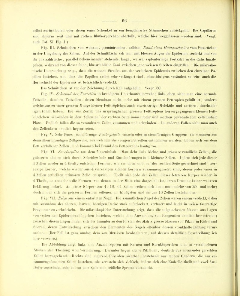selbst zurücklaufen oder deren einer Schenkel in ein benachbartes Stammchen zurückgeht. Die Capillaren sind abnorm weit und mit rothen Blutkörperchen überfüllt, welche hier weggelassen worden sind. (Yergl. auch Taf. XI. Fig. 1.) Fig. III. Schnittchen vom weissen, prominirenden, callösen Rand eines Hautgesclmiirs vom Fussrücken in der Umgebung der Zehen. Auf der Schnittfläche sali man mit blossen Augen die Epidermis verdickt und von ihr aus zahlreiche, parallel nebeneinander stehende, lange, weisse, zapfenförmige Fortsätze in die Cutis hinab- gehen, während von dieser feine, blassröthliche Coni zwischen jene weissen Streifen eingriffen. Die mikrosko- pische Untersuchung zeigt, dass die weissen Streifen aus der verdickten Epidermis zwischen den einzelnen Pa- pillen bestehen, und dass die Papillen selbst sehr verlängert sind, ohne übrigens verändert zu sein; auch die Hornschicht der Epidermis ist beträchtlich verdickt. Das Schnittchen ist vor der Zeichnung durch Kali aufgehellt. Vergr. 80. Fig. IV. Schwund der Fettzellen in brandigem Unterbautzellgewebe; links oben sieht man eine normale Fettzelle, daneben Fettzellen, deren Membran nicht mehr mit einem grossen Fettropfen gefüllt ist, sondern welche ausser einer grossen Menge kleiner Fettlröpfchen auch eiweissartige Moleküle und serösen, durchsich- tigen Inhalt haben. Die aus Zerfall des ursprünglichen grossen Fetttropfens hervorgegangenen kleinen Fett- kügelchen schwinden in den Zellen auf der rechten Seite immer mehr und machen gewöhnlichem Zelleninhalt Platz. Endlich fallen die so veränderten Zellen zusammen und schwinden. In anderen Fällen sieht man auch den Zellenkern deutlich hervortreten. Fig. V. Sehr feine, nadclförmige Fetthry stalle einzeln oder in sternförmigen Gruppen; sie stammen aus demselben brandigen Zellgewebe, aus welchem die vorigen Fettzellen entnommen wurden, bilden sich aus dem Fett zerfallener Zellen, und kommen bei Brand des Fettgewebes häufig vor. Fig. VI. Sarcinejoilze aus dem Mageninhalt. Man sieht links kleine und grössere rundliche Zellen, die grösseren theilen sich durch Scheidewände und Einschnürungen in 4 kleinere Zellen. Indem sich jede dieser 4 Zellen wieder in 4 theilt, entstehen Formen, wie sie oben und auf der rechten Seite gezeichnet sind, vier- eckige Körper, welche wieder aus 4 viereckigen kleinen Körpern zusammengesetzt sind, deren jeder einer in 4 Zellen getheilten primären Zelle entspricht. Tbeilt sich jede der Zellen dieser letzteren Körper wieder in 4 Theile, so entstehen die Formen, von denen in der Mitte eine dargestellt ist, deren Deutung keiner weiteren Erklärung bedarf. An diese Körper von 4, 16, 64 Zellen reihen sich dann noch solche von 256 und mehr; doch finden sich die grösseren Formen seltener, am häufigsten sind die aus 16 Zellen bestehenden. Fig. VII. Pilze aus einem entarteten Nagel. Die sämmtlichen Nägel der Zehen waren enorm verdickt, dabei mit Ausnahme der oberen, harten, hornigen Decke stark aufgelockert, zerfasert und leicht in weisse faserartige Fragmente zu zerbröckeln. Die mikroskopische Untersuchung zeigt, dass die aufgelockerten Massen aus Lagen von verhornten Epidermisschüppchen bestehen, welche ohne Anwendung von Reagentien deutlich hervortreten; zwischen diesen Lagen finden sich bis hinunter zu den Firsten der Matrix grosse Massen von Pilzen in Fäden und Sporen, deren Entwickelung zwischen den Elementen des Nagels offenbar dessen krankhafte Bildung verur- sachte. (Der Fall ist ganz analog dem von Meissner beobachteten, auf dessen detaillirte Beschreibung ich hier verweise.) Die Abbildung zeigt links eine Anzahl Sporen mit Kernen und Kernkörperchen und in verschiedenen Stadien der Theilung und Vermehrung. Darunter liegen kleine Pilzfäden, deutlich aus aneinander gereihten Zellen hervorgehend. Rechts sind mehrere Pilzfäden sichtbar, bestehend aus langen Gliedern, die aus zu- sammengeflossenen Zellen bestehen, sie verästeln sich vielfach, indem sich eine Endzeile theilt und zwei Aus- läufer ausschickt, oder indem eine Zelle eine seitliche Sprosse ausschickt.