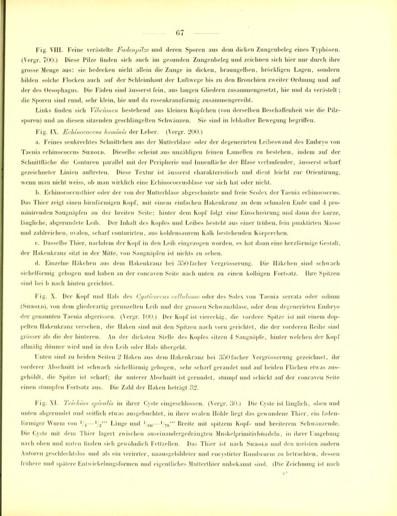 Fig. VIII. Feine verästelte Fadenpilze und deren Sporen aus dem dicken Zungenbeleg eines Typhösen. (Vergr. 700.) Diese Pilze finden sich auch im gesunden Zungenbeleg und zeichnen sich hier nur durch ihre grosse Menge aus: sie bedecken nicht allein die Zunge in dicken, braungelben, bröckligen Lagen, sondern bilden solche Flocken auch auf der Schleimhaut der Luftwege bis zu den Bronchien zweiter Ordnung und auf der des Oesophagus. Die Fäden sind äusserst fein, aus langen Gliedern zusammengesetzt, hie und da verästelt; die Sporen sind rund, sehr klein, hie und da rosenkranzförmig zusammengereiht. Links finden sich Vibrionen bestehend aus kleinen Köpfchen (von derselben Beschaffenheit wie die Pilz- sporen) und an diesen sitzenden geschlängelten Schwänzen. Sie sind in lebhafter Bewegung begriffen. Fig. IX. Echinococcus hominis der Leber. (Vergr. 200.) a. Feines senkrechtes Schnittchen aus der Mutterblase oder der degenerirten Leibeswand des Embryo von Taenia ecliinococcus Siebold. Dieselbe scheint aus unzähligen feinen Lamellen zu bestehen, indem auf der Schnittfläche die Conturen parallel mit der Peripherie und Innenfläche der Blase verlaufender, äusserst scharf gezeichneter Linien auftreten. Diese Textur ist äusserst charakteristisch und dient leicht zur Orientirung, wenn man nicht weiss, ob man wirklich eine Echinococcusblase vor sich hat oder nicht. b. Echinococcusthier oder der von der Mutterblase abgeschnürte und freie Scolex der Taenia ecliinococcus. Das Thier zeigt einen bimförmigen Kopf, mit einem einfachen Hakenkranz an dem schmalen Ende und 4 pro- minirenden Saugnäpfen an der breiten Seite; hinter dem Kopf folgt eine Einschnürung und dann der kurze, längliche, abgerundete Leib. Der Inhalt des Kopfes und Leibes besteht aus einer trüben, fein punktirten Masse und zahlreichen, ovalen, scharf conturirten, aus kohlensaurem Kalk bestehenden Körperchen. c. Dasselbe Thier, nachdem der Kopf in den Leib eingezogen worden, es bat dann eine herzförmige Gestalt, der Hakenkranz sitzt in der Mitte, von Saugnäpfen ist nichts zu sehen. d. Einzelne Häkchen aus dem Hakenkranz bei 350facher Vergrösserung. Die Häkchen sind schwach sichelförmig gebogen und haben an der concaven Seile nach unten zu einen kolbigen Fortsatz, ihre Spitzen sind bei b nach hinten gerichtet. Fig. X. Der Kopf und Hals des Cysticercus cellulosae oder des Solex von Taenia serrata oder solium (Siebold), von dem gliederartig gerunzelten Leib und der grossen Schwanzblase, oder dem degenerirten Embryo der genannten Taenia abgerissen. (Vergr. 100.) Der Kopf ist viereckig, die vordere Spitze ist mit einem dop- pelten Hakenkranz versehen, die Haken sind mit den Spitzen nach vorn gerichtet, die der vorderen Reihe sind grösser als die der hinteren. An der dicksten Stelle des Kopfes sitzen 4 Saugnäpfe, hinter welchen der Kopf allmälig dünner wird und in den Leib oder Hals übergeht. Unten sind zu beiden Seiten 2 Haken aus dem Hakenkranz bei 350facher Vergrösserung gezeichnet, ihr vorderer Abschnitt ist schwach sichelförmig gebogen, sehr scharf gerandet und auf beiden Flächen etwas aus- gehöhlt, die Spitze ist scharf; ihr unterer Abschnitt ist gerundet, stumpf und schickt auf der concaven Seite einen stumpfen Fortsatz aus. Die Zahl der Haken beträgt 32. Fig. XL Trichius spiralis in ihrer Cyste eingeschlossen. (Vergr. 30.) Die Cyste ist länglich, oben und unten abgerundet und seitlich etwas ausgebuchlet, in ihrer ovalen Höhle liegt das gewundene Thier, ein faden- förmiger Wurm von i/4—1/2' Länge und ]/60—i/70/ Breite mit spitzem Kopf- und breiterem Schwanzende. Die Cyste mit dem Thier lagert zwischen auseinandergedrängten Muskelprimitivbiindeln, in ihrer Umgebung nach oben und unten linden sich gewöhnlich Fettzellen. Das Thier ist nach Siebold und den meisten andern Autoren geschlechtslos und als ein verirrter, unausgebildeter und encystirter Rundwurm zu betrachten, dessen frühere und spätere Entwickelungsformen und eigentliches Multerthier unbekannt sind. (Die Zeichnung ist nach u *