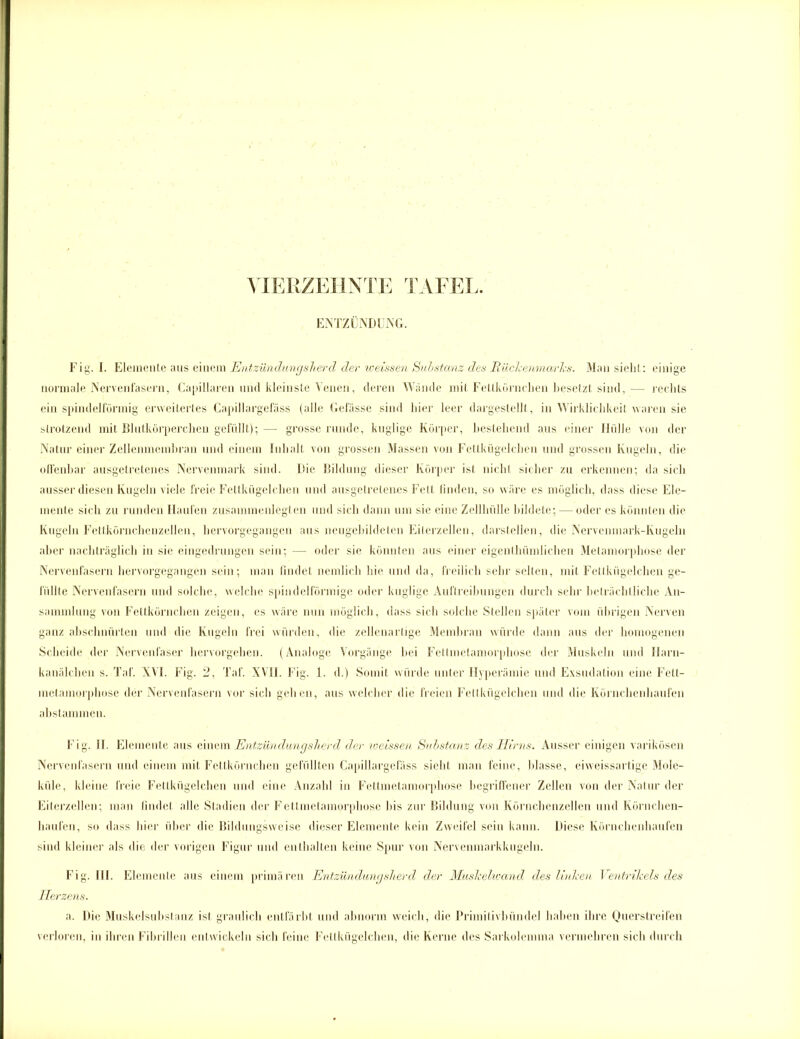 VIERZEHNTE ENTZÜNDUNG. Fig. I. Elemente aus einem Entzündungsherd der weissen Substanz des Rückenmarks. Man sieht: einige normale Nervenfasern, Capillaren und kleinste Venen, deren Wände mit Fettkörnchen besetzt sind, — rechts ein spindelförmig erweitertes Capillargefäss (alle Gefässe sind hier leer dargestellt, in Wirklichkeit waren sie strotzend mit Blutkörperchen gefüllt); — grosse runde, kuglige Körper, bestehend aus einer Hülle von der Natur einer Zellenmembran und einem Inhalt von grossen Massen von Fettkügelchen und grossen Kugeln, die offenbar ausgetretenes Nervenmark sind. Die Bildung dieser Körper ist nicht sicher zu erkennen; da sich ausser diesen Kugeln viele freie Fettkügelchen und ausgetretenes Fett finden, so wäre es möglich, dass diese Ele- mente sich zu runden Haufen zusammenlcgten und sich dann um sie eine Zellhülle bildete; — oder es könnten die Kugeln Fettkörnchenzellen, hervorgegangen aus neugebildeten Eiterzellen, darstellen, die Nervenmark-Kugeln aber nachträglich in sie eingedrungen sein; — oder sie könnten aus einer eigenthümlichen Metamorphose der Nervenfasern hervorgegangen sein; man findet nemlich hie und da, freilich sehr selten, mit Fettkügelchen ge- füllte Nervenfasern und solche, welche spindelförmige oder kuglige Auftreibungen durch sehr beträchtliche An- sammlung von Fettkörnchen zeigen, es wäre nun möglich, dass sich solche Stellen später vom übrigen Nerven ganz abschnürten und die Kugeln frei würden, die zellenartige Membran würde dann aus der homogenen Scheide der Nervenfaser hervorgehen. (Analoge Vorgänge bei Fettmetamorphose der Muskeln und Harn- kanälchen s. Taf. XVI. Fig. 2, Taf. XVII. Fig. 1. d.) Somit würde unter Hyperämie und Exsudation eine Fett- metamorphose der Nervenfasern vor sich gehen, aus welcher die freien Fettkügelchen und die Körnchenhaufen abstammen. Fig. II. Elemente aus einem Entzündungsherd der weissen Substanz des Hirns. Ausser einigen varikösen Nervenfasern und einem mit Fettkörnchen gefüllten Capillargefäss sieht man feine, blasse, eiweissartige Mole- küle, kleine freie Fettkügelchen und eine Anzahl in Fettmetamorphose begriffener Zellen von der Natur der Eiterzellen; man findet alle Stadien der Fettmetamorphose bis zur Bildung von Körncbenzellen und Körnchen- haufen, so dass hier über die Bildungsweise dieser Elemente kein Zweifel sein kann. Diese Körnchenhaufen sind kleiner als die der vorigen Figur und enthalten keine Spur von Nervenmarkkugeln. Fig. III. Elemente aus einem primären Entzündungsherd der Muskelioand des linken Ventrikels des Herzens. a. Die Muskelsubstanz ist graulich entfärbt und abnorm weich, die Primitivbündel haben ihre Querstreifen verloren, in ihren Fibrillen entwickeln sich feine Fettkügelchen, die Kerne des Sarkolennna vermehren sich durch