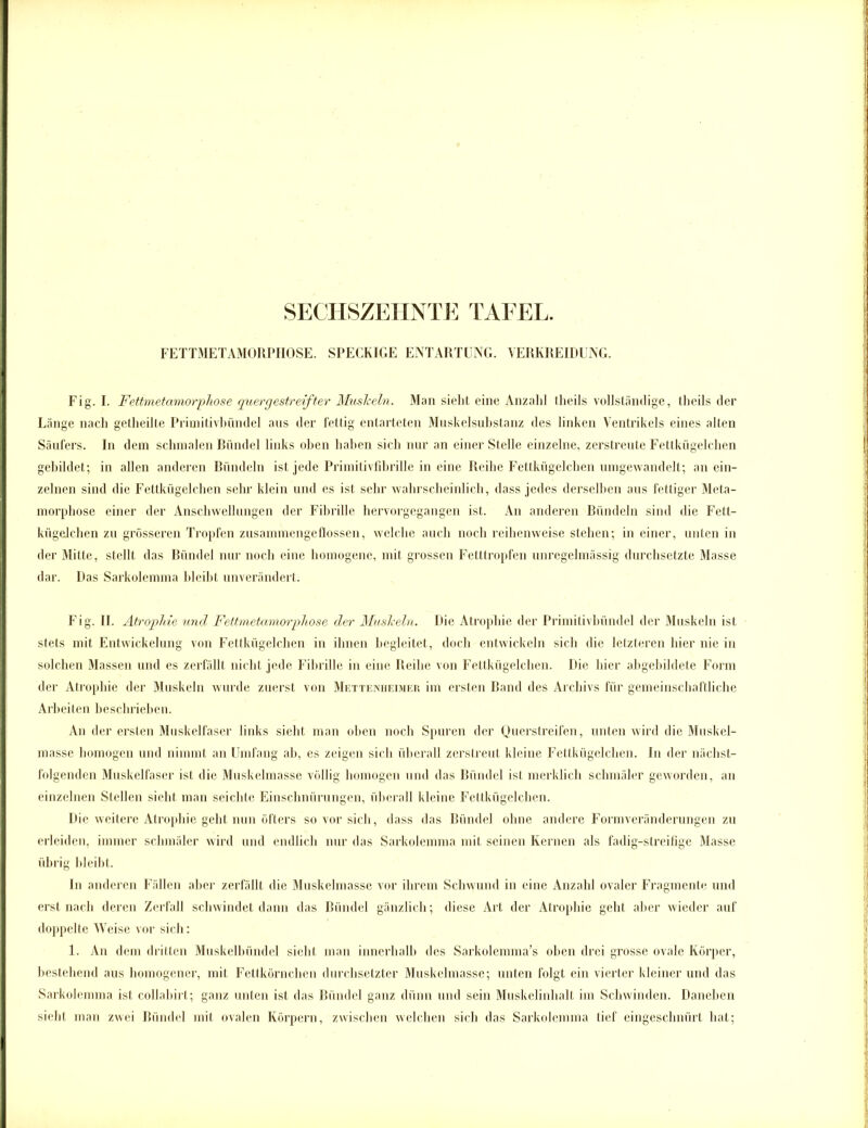 FETTMETAMORPHOSE. SPECKIGE ENTARTUNG. VERKREIDUNG. Fig. I. Fettmetamorphose quergestreifter Muskeln. Man sieht eine Anzahl theils vollständige, theils der Länge nach getheilte Primitivbündel aus der l'ettig entarteten Muskelsubstanz des linken Ventrikels eines alten Säufers. In dem schmalen Riindel links oben haben sich nur an einer Stelle einzelne, zerstreute Fettkügelchen gebildet; in allen anderen Ründeln ist jede Primitivfibrille in eine Reihe Fettkügelchen umgewandelt; an ein- zelnen sind die Fettkügelchen sehr klein und es ist sehr wahrscheinlich, dass jedes derselben aus fettiger Meta- morphose einer der Anschwellungen der Fibrille hervorgegangen ist. An anderen Bündeln sind die Fett- kügelchen zu grösseren Tropfen zusammengeflossen, welche auch noch reihenweise stehen; in einer, unten in der Mitte, stellt das Bündel nur noch eine homogene, mit grossen Fetttropfen unregelmässig durchsetzte Masse dar. Das Sarkolemma bleibt unverändert. Fig. II. Atrophie und Fettmetamorphose der Muskeln. Die Atrophie der Primitivbündel der Muskeln ist stets mit Entwickelung von Fettkügelchen in ihnen begleitet, doch entwickeln sich die letzteren hier nie in solchen Massen und es zerfällt nicht jede Fibrille in eine Reihe von Fettkügelchen. Die hier abgebildete Form der Atrophie der Muskeln wurde zuerst von Mettenheimer im ersten Band des Archivs für gemeinschaftliche Arbeiten beschrieben. An der ersten Muskelfaser links sieht man oben noch Spuren der Querstreifen, unten wird die Muskel- masse homogen und nimmt an Umfang ah, es zeigen sich überall zerstreut kleine Fettkügelchen, ln der nächst- folgenden Muskelfaser ist die Muskelmasse völlig homogen und das Bündel ist merklich schmäler geworden, an einzelnen Stellen sieht man seichte Einschnürungen, überall kleine Fettkügelchen. Die weitere Atrophie geht nun öfters so vor sich, dass das Bündel ohne andere Formveränderungen zu erleiden, immer schmäler wird und endlich nur das Sarkolemma mit seinen Kernen als fadig-streifige Masse übrig bleibt. ln anderen Fällen aber zerfällt die Muskelmasse vor ihrem Schwund in eine Anzahl ovaler Fragmente und erst nach deren Zerfall schwindet dann das Bündel gänzlich; diese Art der Atrophie geht aber wieder auf doppelte Weise vor sich: 1. An dem dritten Muskelbündel sieht man innerhalb des Sarkolennna’s oben drei grosse ovale Körper, bestehend aus homogener, mit Fettkörnchen durchsetzter Muskelmasse; unten folgt ein vierter kleiner und das Sarkolemma ist collabirt; ganz unten ist das Bündel ganz dünn und sein Muskelinhalt im Schwinden. Daneben sieht man zwei Bündel mit ovalen Körpern, zwischen welchen sich das Sarkolemma tief eingeschnürt hat;