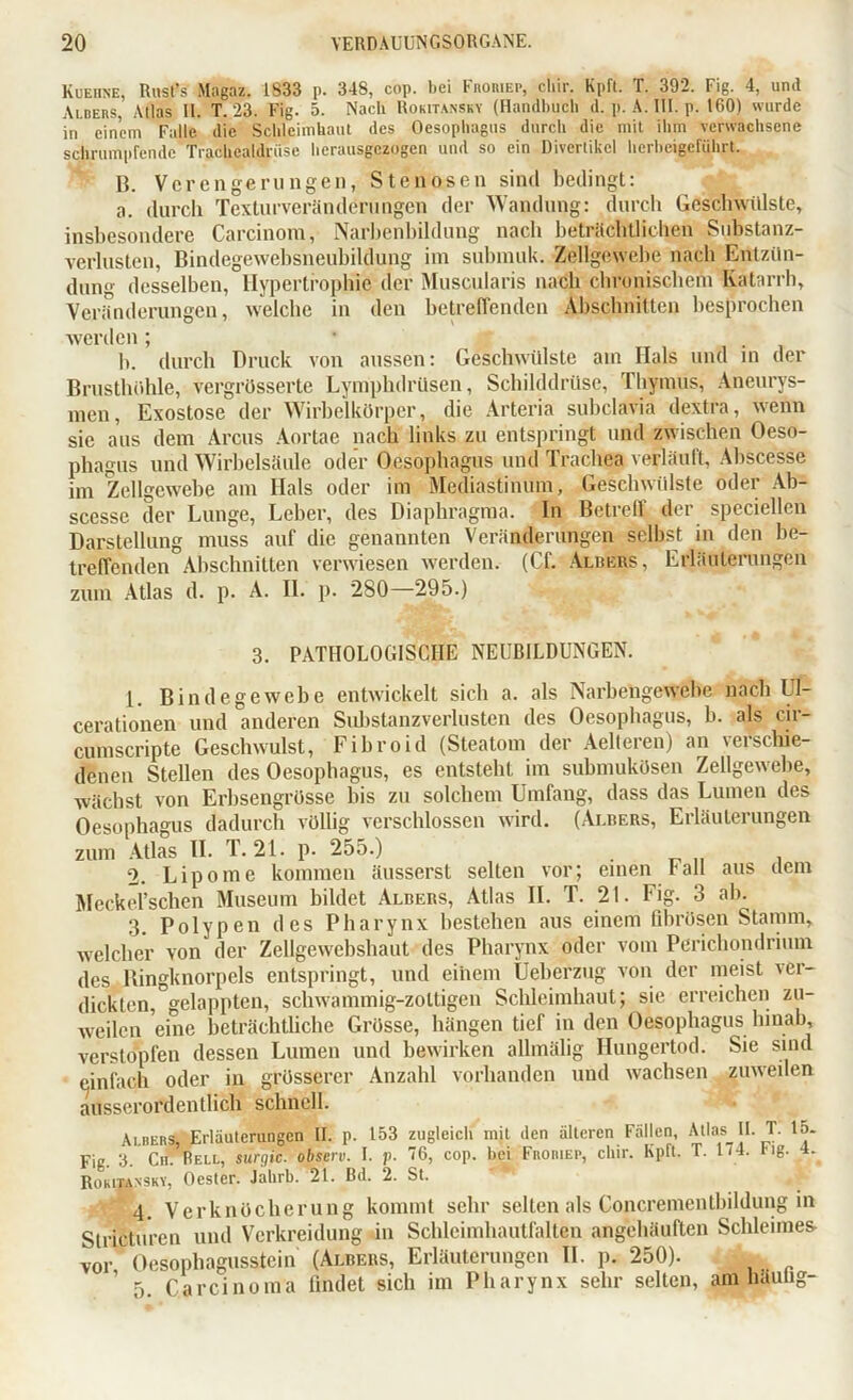 Kueiine, Rust’s Magaz. 1833 p. 348, cop. bei Froriep, cliir. Kpft. T. 392. Fig. 4, und Albers, Alias 11. T. 23. Fig. 5. Nach Rokitansky (Handbuch d. p. A. III. p. 160) wurde in einem Falle, die Schleimhaut des Oesophagus durch die mit ihm verwachsene schrumpfende Trachealdriise herausgezogen und so ein Divertikel herbeigeführt. B. Verengerungen, Stenosen sind bedingt: a. durch Texturverän der ungen der Wandung: durch Geschwülste, insbesondere Carcinom, Narbenbildung nach beträchtlichen Substanz- verlusten, Bindegewebsneubildung im submuk. Zellgewebe nach Entzün- dung desselben, Hypertrophie der Muscularis nach chronischem Katarrh, Veränderungen, welche in den betreffenden Abschnitten besprochen werden ; b. durch Druck von aussen: Geschwülste am Hals und in der Brusthöhle, vergrösserte Lymphdrüsen, Schilddrüse, Thymus, Aneurys- men, Exostose der Wirbelkörper, die Arteria subclavia dextra, wenn sie aus dem Arcus Aortae nach links zu entspringt und zwischen Oeso- phagus und Wirbelsäule oder Oesophagus und Trachea verläuft, Abscesse im Zellgewebe am Hals oder im Mediastinum, Geschwülste oder Ab- scesse der Lunge, Leber, des Diaphragma. In Betreff der speciellen Darstellung muss auf die genannten Veränderungen selbst in den be- treffenden Abschnitten verwiesen werden. (Cf. Albers, Erläuterungen zum Atlas d. p. A. II. p. 280—295.) 3. PATHOLOGISCHE NEUBILDUNGEN. 1. Bindegewebe entwickelt sich a. als Narbengewebe nach Uf- cerationen und anderen Substanzverlusten des Oesophagus, b. als cir- cumscripte Geschwulst, Fibroid (Steatom der Aelteren) an verschie- denen Stellen des Oesophagus, es entsteht im submukösen Zellgewebe, wächst von Erbsengrösse bis zu solchem Umfang, dass das Lumen des Oesophagus dadurch völlig verschlossen wird. (Ai.bers, Erläuterungen zum Atlas II. T. 21. p. 255.) 2. Lipome kommen äusserst selten vor; einen fall aus dem Meck ersehen Museum bildet Albers, Atlas II. T. 21. Fig. 3 ab. 3. Polypen des Pharynx bestehen aus einem fibrösen Stamm, welcher von der Zellgewebshaut des Pharynx oder vom Perichondrium des Ringknorpels entspringt, und einem Ueberzug von der meist ver- dickten, gelappten, schwammig-zottigen Schleimhaut; sie erreichen zu- weilen eine beträchtliche Grösse, hängen tief in den Oesophagus hinab, verstopfen dessen Lumen und bewirken allmälig Hungertod. Sie sind einfach oder in grösserer Anzahl vorhanden und wachsen zuweilen ausserordentlich schnell. Ai bers, Erläuterungen II. p. 153 zugleich mit den älteren Fällen, Atlas II. T. 15. Fig. 3. Cif! Rell, surqic. observ. I. p. 76, cop. bei Froriep, cliir. Kpft. T. 174. l ig. 4. Rokitansky, Oester. Jahrb. 21. ßd. 2. St. 4. Verknöcherung kommt sehr selten als Concrementbildung in Slricturcn und Verkreidung in Schleimhautfalten angehäuften Schleimes- vor Oesophagusstein (Albers, Erläuterungen II. p. 250). ’ 5 Carcinoma findet sich im Pharynx sehr selten, am heutig-