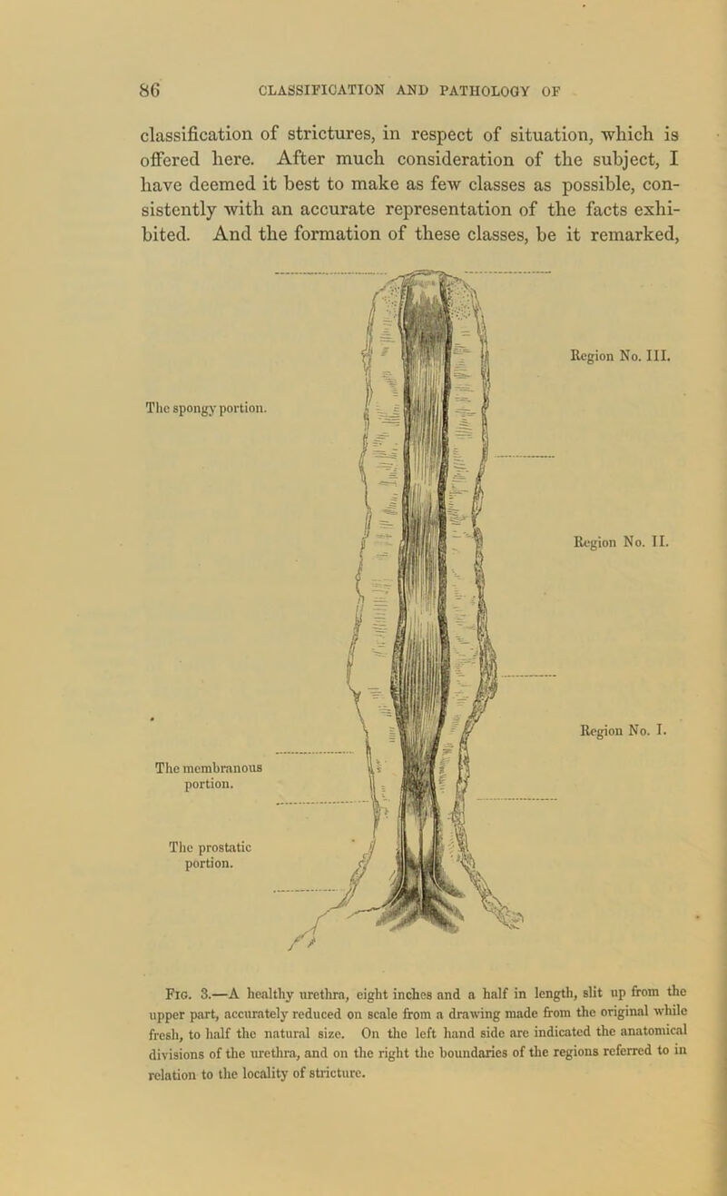 classification of strictures, in respect of situation, which is offered here. After much consideration of the subject, I have deemed it best to make as few classes as possible, con- sistently with an accurate representation of the facts exhi- bited. And the formation of these classes, be it remarked, The spongy portion. The membranous portion. The prostatic portion. Region No. III. Region No. II. Region No. I. Fig. 3.—A healthy urethra, eight inches and a half in length, slit up from the upper part, accurately reduced on scale from a drawing made from the original while fresh, to half the natural size. On the left hand side are indicated the anatomical divisions of the urethra, and on the right the boundaries of the regions referred to in relation to the locality of stricture.