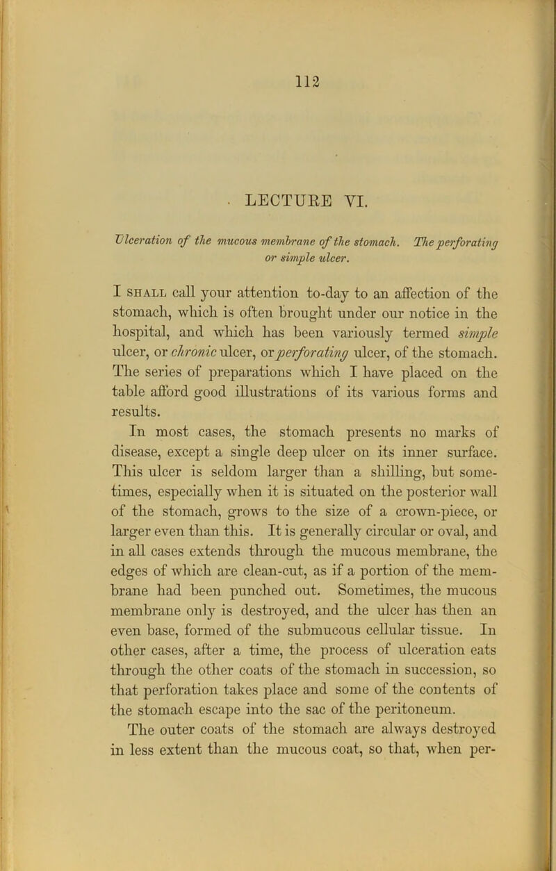 • LECTURE YI. Ulceration of the mucous membrane of the stomach. The perforating or simple ulcer. I shall call your attention to-day to an affection of the stomach, which is often Brought under our notice in the hospital, and which has been variously termed simple ulcer, or chronic ulcer, ox perforating ulcer, of the stomach. The series of preparations which I have placed on the table afford good illustrations of its various forms and results. In most cases, the stomach presents no marks of disease, except a single deep ulcer on its inner surface. This ulcer is seldom larger than a shilling, but some- times, especially when it is situated on the posterior wall of the stomach, grows to the size of a crown-piece, or larger even than this. It is generally circular or oval, and in all cases extends through the mucous membrane, the edges of which are clean-cut, as if a portion of the mem- brane had been punched out. Sometimes, the mucous membrane only is destroyed, and the ulcer has then an even base, formed of the submucous cellular tissue. In other cases, after a time, the process of ulceration eats through the other coats of the stomach in succession, so that perforation takes place and some of the contents of the stomach escape into the sac of the peritoneum. The outer coats of the stomach are always destroyed in less extent than the mucous coat, so that, when per-