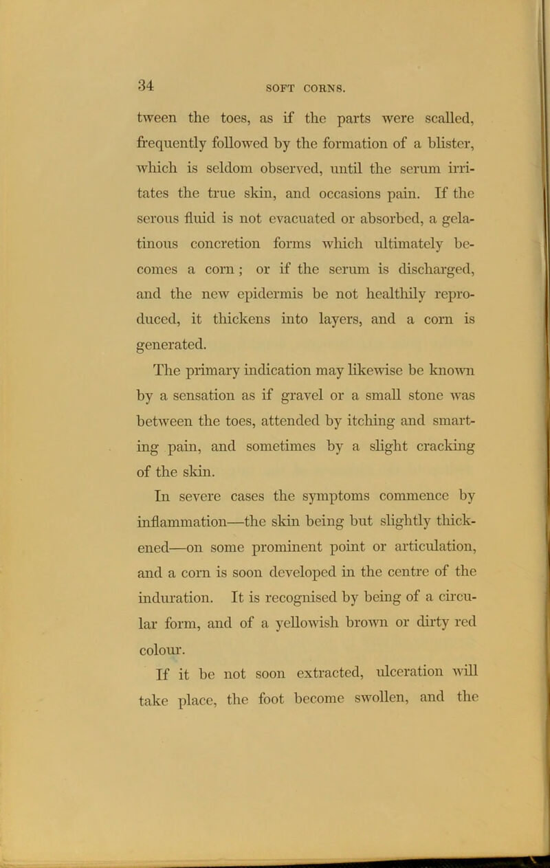 tween the toes, as if the parts were scallcd, frequently followed by the formation of a blister, which is seldom observed, until the serum irri- tates the true skin, and occasions pain. If the serous fluid is not evacuated or absorbed, a gela- tinous concretion forms which ultimately be- comes a corn ; or if the serum is discharged, and the new epidermis be not healthily repro- duced, it thickens into layers, and a corn is generated. The primary indication may likewise be known by a sensation as if gravel or a small stone was between the toes, attended by itching and smart- ing pain, and sometimes by a slight cracking of the skin. In severe cases the symptoms commence by inflammation—the skin being but slightly thick- ened—on some prominent point or articulation, and a corn is soon developed in the centre of the induration. It is recognised by being of a circu- lar form, and of a yellowish brown or dirty red colour. If it be not soon extracted, ulceration will take place, the foot become swollen, and the