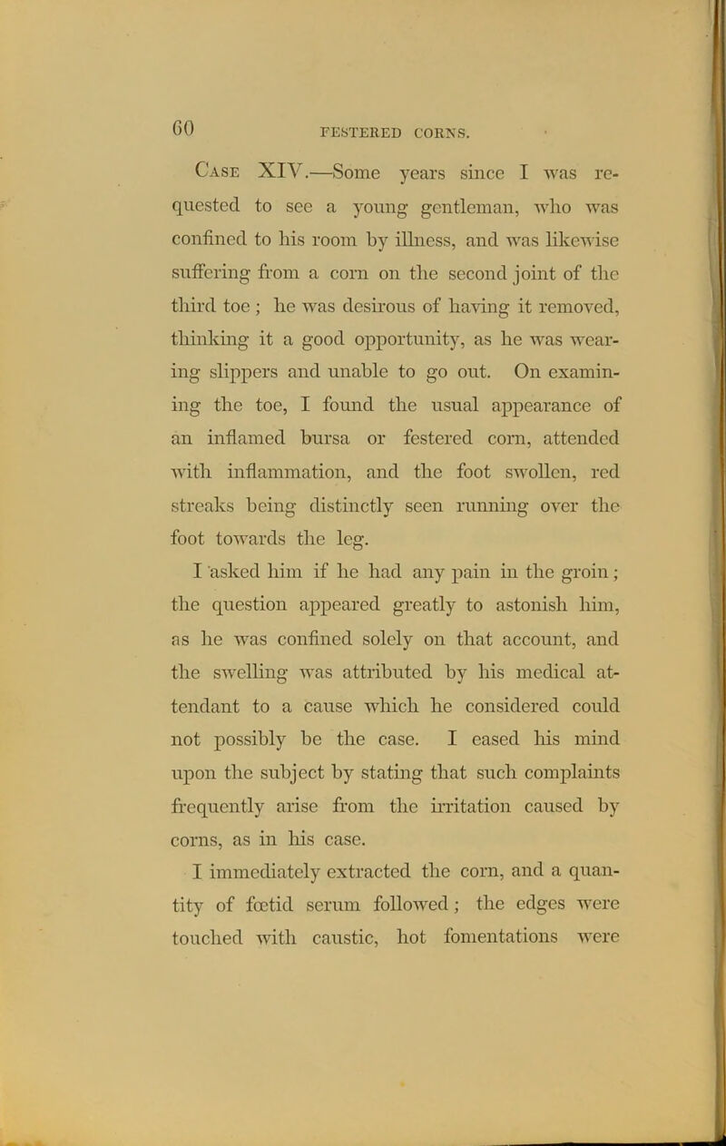 GO Case XIV.—Some years since I was re- quested to see a young gentleman, who was confined to Ills room by illness, and was likewise suffering from a corn on the second joint of the third toe ; he was desirous of having it removed, thinking it a good opportunity, as he was wear- ing slippers and unable to go out. On examin- ing the toe, I found the usual appearance of an inflamed bursa or festered corn, attended with inflammation, and the foot swollen, red streaks being distinctly seen running over the foot towards the leg. I asked him if he had any pain in the groin; the question appeared greatly to astonish him, as he was confined solely on that account, and the swelling was attributed by his medical at- tendant to a cause which he considered could not possibly be the case. I eased his mind upon the subject by stating that such complaints frequently arise from the irritation caused by corns, as in his case. I immediately extracted the corn, and a quan- tity of foetid serum followed; the edges were touched with caustic, hot fomentations were
