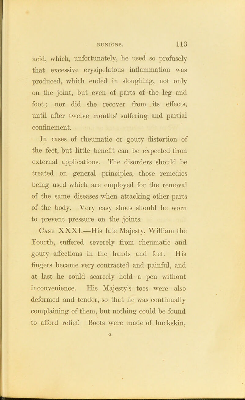 acicl, which, unfortunately, he used so profusely that excessive erysipelatous inflammation was produced, which ended in sloughing, not only on the joint, but even of parts of the leg and foot; nor did she recover from its effects, until after twelve months’ suffering and partial confinement. In cases of rheumatic or gouty distortion of the feet, but little benefit can be expected from external applications. The disorders should be treated on general principles, those remedies being used which are employed for the removal of the same diseases when attacking other parts of the body. Very easy shoes should be worn to prevent pressure on the joints. Case XXXI.—His late Majesty, William the Fourth, suffered severely from rheumatic and gouty affections in the hands and feet. His fingers became very contracted and painful, and at last he could scarcely hold a pen without inconvenience. His Majesty’s toes were also deformed and tender, so that he was continually complaining of them, but nothing could be found to afford relief. Boots were made of buckskin,