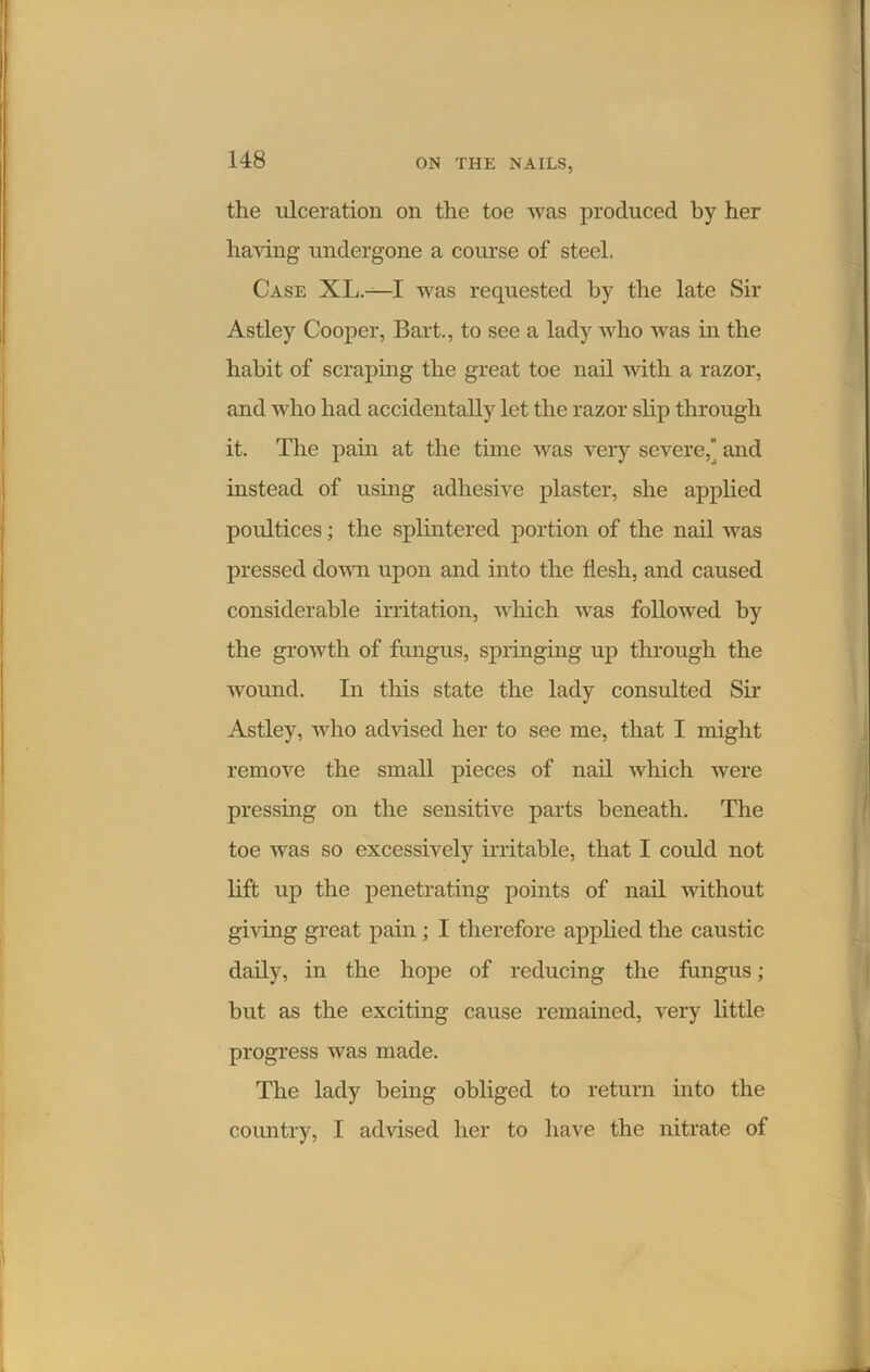 the ulceration on the toe was produced by her having undergone a course of steel. Case XL.-^-I was requested by the late Sir Astley Cooper, Bart., to see a lady who was in the habit of scraping the great toe nail with a razor, and who had accidentally let the razor slip through it. The pain at the time was very severe, and instead of using adhesive plaster, she applied poultices; the splintered portion of the nail was pressed down upon and into the flesh, and caused considerable irritation, which was followed by the growth of fungus, springing up through the wound. In this state the lady consulted Sir Astley, who advised her to see me, that I might remove the small pieces of nail which were pressing on the sensitive parts beneath. The toe was so excessively irritable, that I could not lift up the penetrating points of nail without giving great pain; I therefore applied the caustic daily, in the hope of reducing the fungus; but as the exciting cause remained, very little progress was made. The lady being obliged to return into the country, I advised her to have the nitrate of