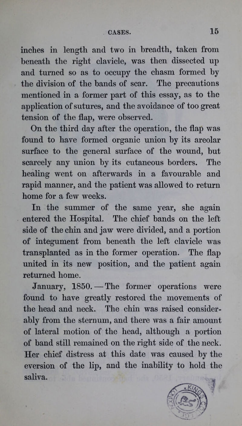 inches in length and two in breadth, taken from beneath the right clavicle, was then dissected up and turned so as to occupy the chasm formed by the division of the hands of scar. The precautions mentioned in a former part of this essay, as to the application of sutures, and the avoidance of too great tension of the flap, were observed. On the third day after the operation, the flap was found to have formed organic union by its areolar surface to the general surface of the wound, but scarcely any union by its cutaneous borders. The healing went on afterwards in a favourable and rapid manner, and the patient was allowed to return home for a few weeks. In the summer of the same year, she again entered the Hospital. The chief bands on the left side of the chin and jaw were divided, and a portion of integument from beneath the left clavicle was transplanted as in the former operation. The flap united in its new position, and the patient again returned home. January, 1850. — The former operations were found to have greatly restored the movements of the head and neck. The chin was raised consider- ably from the sternum, and there was a fair amount of lateral motion of the head, although a portion of band still remained on the right side of the neck. Her chief distress at this date was caused by the eversion of the lip, and the inability to hold the saliva.