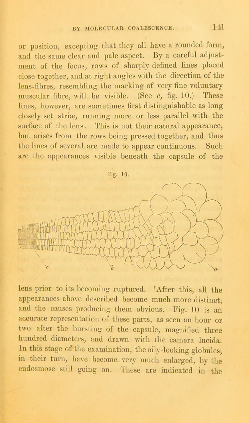 or position, excepting tliat they all have a rounded form, and the same clear and pale aspect. By a careful adjust- ment of the focus, rows of sharply defined lines placed close together, and at right angles with the direction of the lens-fibres, resembling the marking of vei’y fine voluntary muscular fibre, will he visible. (See c, fig. 10.) These lines, however, are sometimes first distinguishable as long closely set strife, running more or less parallel with the surface of the lens. This is not their natural appearance, but arises from the rows being pressed together, and thus the lines of several are made to appear continuous. Such are the appearances visible beneath the capsule of the Fig. 10. lens prior to its becoming ruptured. rAfter this, all the appearances above described become much more distinct, and the causes producing them obvious. Fig. 10 is an accurate representation of these parts, as seen an hour or two after the bursting of the capsule, magnified three hundred diameters, and drawn with the camera lucida. In tins stage of the examination, the oily-looking globules, in their turn, have become very much enlarged, by the endosmose still going on. These are indicated in the