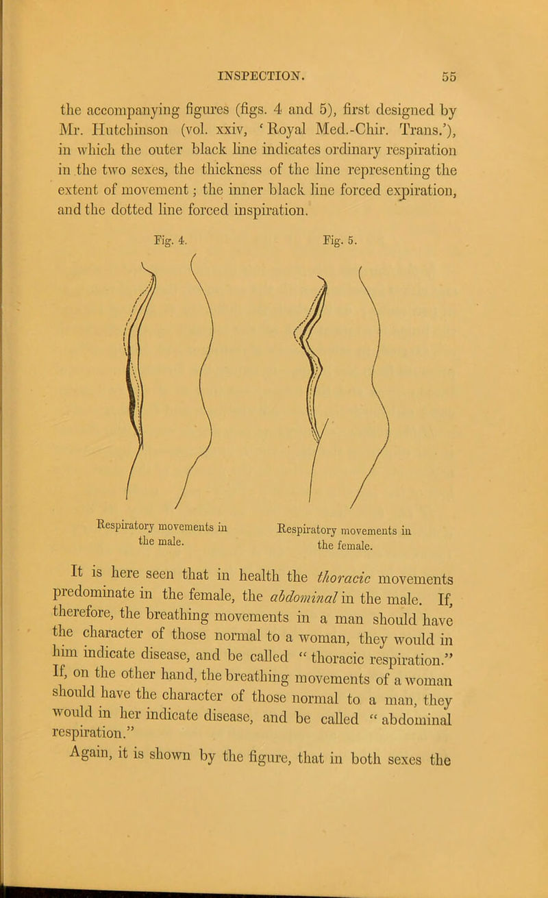 the accompanying figures (figs. 4 and 5), first designed by Mr. Hutchinson (vol. xxiv, ‘ Royal Med.-Chir. Trans.’), in which the outer black line indicates ordinary respiration in the two sexes, the thickness of the line representing the extent of movement; the inner black line forced expiration, and the dotted line forced inspiration. Respiratory movements in the male. Eig. 5. Respiratory movements in the female. It is here seen that in health the thoracic movements predominate in the female, the abdominal in the male. If, therefore, the breathing movements in a man should have the character of those normal to a woman, they would in him indicate disease, and be called  thoracic respiration.” If, on the other hand, the breathing movements of a woman should have the character of those normal to a man, they a\ ould in her indicate disease, and be called “ abdominal respiration.” Again, it is shown by the figure, that in both sexes the