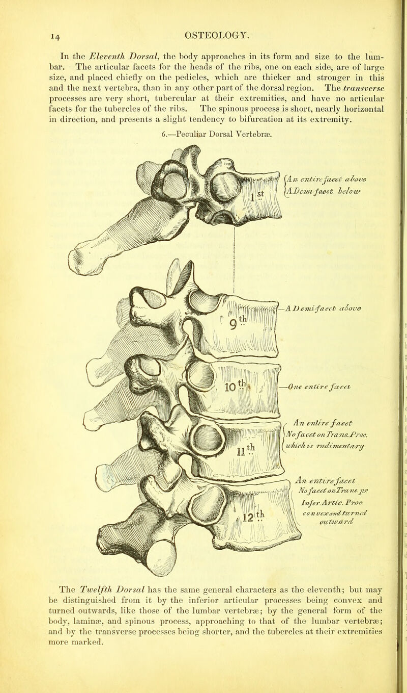 H In the Eleventh Dorsal, the body approaches in its form and size to the lum- bar. The articular facets for the heads of the ribs, one on each side, are of large size, and placed chiefly on the pedicles, which are thicker and stronger in this and the next vertebra, than in any other part of the dorsal region. The transverse processes are very short, tubercular at their extremities, and have no articular facets for the tubercles of the ribs. The spinous process is short, nearly horizontal in direction, and presents a slight tendency to bifurcation at its extremity. 6.—Peculiar Dorsal Vertebra;. [A n entire facet alcove \AT cm i facet 1) el our AD emi-faccb aiove ■One entire facet - A n entire facet Nofacet on Tra.ns.Proe, which, vs rudimentar/j An entire facet No facet onTru.ns.pr Infer. Artie. Free con u cor and turned outward The Twelfth Dorsal has the same general characters as the eleventh; but may be distinguished from it by the inferior articular processes being convex and turned outwards, like those of the lumbar vertebra;; by the general form of the body, laminae, and spinous process, approaching to that of the lumbar vertebrae; and by the transverse processes being shorter, and the tubercles at their extremities more marked.