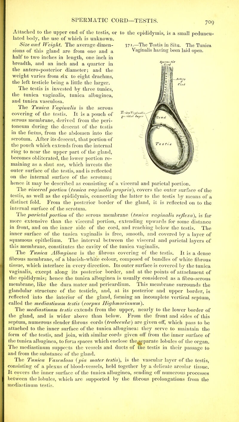 SPERMATIC CORD—TESTIS. 371.—The Testis in Situ. The Tunica Vaginalis having been laid open. 7° 9 Attached to the upper end of the testis, or to the epididymis, is a small peduncu- lated body, the use of which is unknown. Size and Weight. The average dimen- sions of this gland are from one and a half to two inches in length, one inch in breadth, and an inch and a quarter in the antero-posterior diameter; and the weight varies from six to eight drachms, the left testicle being a little the larger. The testis is invested by three tunics, the tunica vaginalis, tunica albuginea, and tunica vasculosa. The Tunica Vaginalis is the serous covering of the testis. It is a pouch of serous membrane, derived from the peri- toneum during the descent of the testis in the foetus, from the abdomen into the scrotum. After its descent, that portion of the pouch which extends from the internal ring to near the upper part of the gland, becomes obliterated, the lower portion re- maining as a shut sac, which invests the outer surface of the testis, and is reflected on the internal surface of the scrotum; hence it may be described as consisting of a visceral and parietal portion. The visceral portion (tunica vaginalis propria), covers the outer surface of the testis, as well as the epididymis, connecting the latter to the testis by means of a distinct fold. From the posterior border of the gland, it is reflected on to the internal surface of the scrotum. The parietal portion of the serous membrane (tunica vaginalis reftexa), is far more extensive than the visceral portion, extending upwards for some distance in front, and on the inner side of the cord, and reaching below the testis. The inner surface of the tunica vaginalis is free, smooth, and covered by a layer of squamous epithelium. The interval between the visceral and parietal layers of this membrane, constitutes the cavity of the tunica vaginalis. The Tunica Albuginea is the fibrous covering of the testis. It is a dense fibrous membrane, of a blueisli-whit'e colour, composed of bundles of white fibrous tissue, which interlace in every direction. Its outer surface is covered by the tunica vaginalis, except along its posterior border, and at the points of attachment of the epididymis; hence the tunica albuginea is usually considered as a fibro-serous membrane, like the dura mater and pericardium. This membrane surrounds the glandular structure of the testicle, and, at its posterior and upper border, is reflected into the interior of the gland, forming an incomplete vertical septum, called the mediastinum testis (corpus Highmorianum). The mediastinum testis extends from the upper, nearly to the lower border of the gland, and is wider above than below. From the front and sides of this septum, numerous slender fibrous cords (trabecula) are given off, which pass to be attached to the inner surface of the tunica albuginea: they serve to maintain the form of the testis, and join, with similar cords given off from the inner surface of the tunica albuginea, to form spaces which enclose the^eparate lobules of the organ. The mediastinum supports the vessels and ducts of the testis in their passage to and from the substance of the gland. The Tunica Vasculosa (pia mater testis), is the vascular layer of the testis, consisting of a plexus of blood-vessels, held together by a delicate areolar tissue. It covers the inner surface of the tunica albuginea, sending off numerous processes between the lobules, which are supported by the fibrous prolongations from the mediastinum testis.