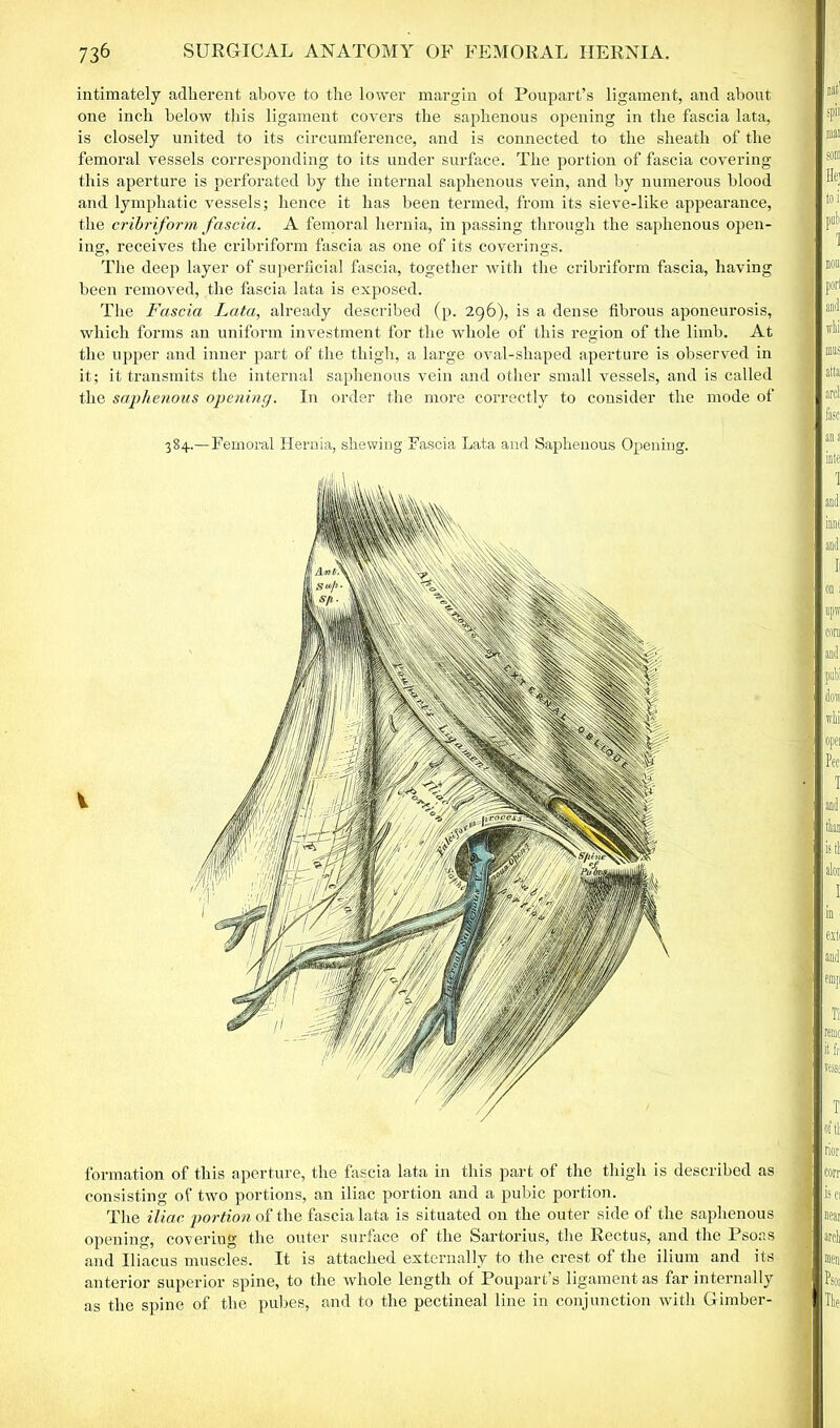 intimately adherent above to the lower margin of Poupart’s ligament, and about one inch below this ligament covers the saphenous opening in the fascia lata, is closely united to its circumference, and is connected to the sheath of the femoral vessels corresponding to its under surface. The portion of fascia covering this aperture is perforated by the internal saphenous vein, and by numerous blood and lymphatic vessels; hence it has been termed, from its sieve-like appearance, the cribriform fascia. A femoral hernia, in passing through the saphenous open- ing, receives the cribriform fascia as one of its coverings. The deep layer of superficial fascia, together with the cribriform fascia, having been removed, the fascia lata is exposed. The Fascia Lata, already described (p. 296), is a dense fibrous aponeurosis, which forms an uniform investment for the whole of this region of the limb. At the upper and inner part of the thigh, a large oval-shaped aperture is observed in it; it transmits the internal saphenous vein and other small vessels, and is called the saphenous opening. In order the more correctly to consider the mode of 384.— Femoral Hernia, shewing Fascia Lata and Saphenous Opening. formation of this aperture, the fascia lata in this part of the thigh is described as consisting of two portions, an iliac portion and a pubic portion. The iliac portion of the fascia lata is situated on the outer side of the saphenous opening, covering the outer surface of the Sartorius, the Rectus, and the Psoas and Iliacus muscles. It is attached externally to the crest of the ilium and its anterior superior spine, to the whole length of Poupart’s ligament as far internally as the spine of the pubes, and to the pectineal line in conjunction with Gimber-