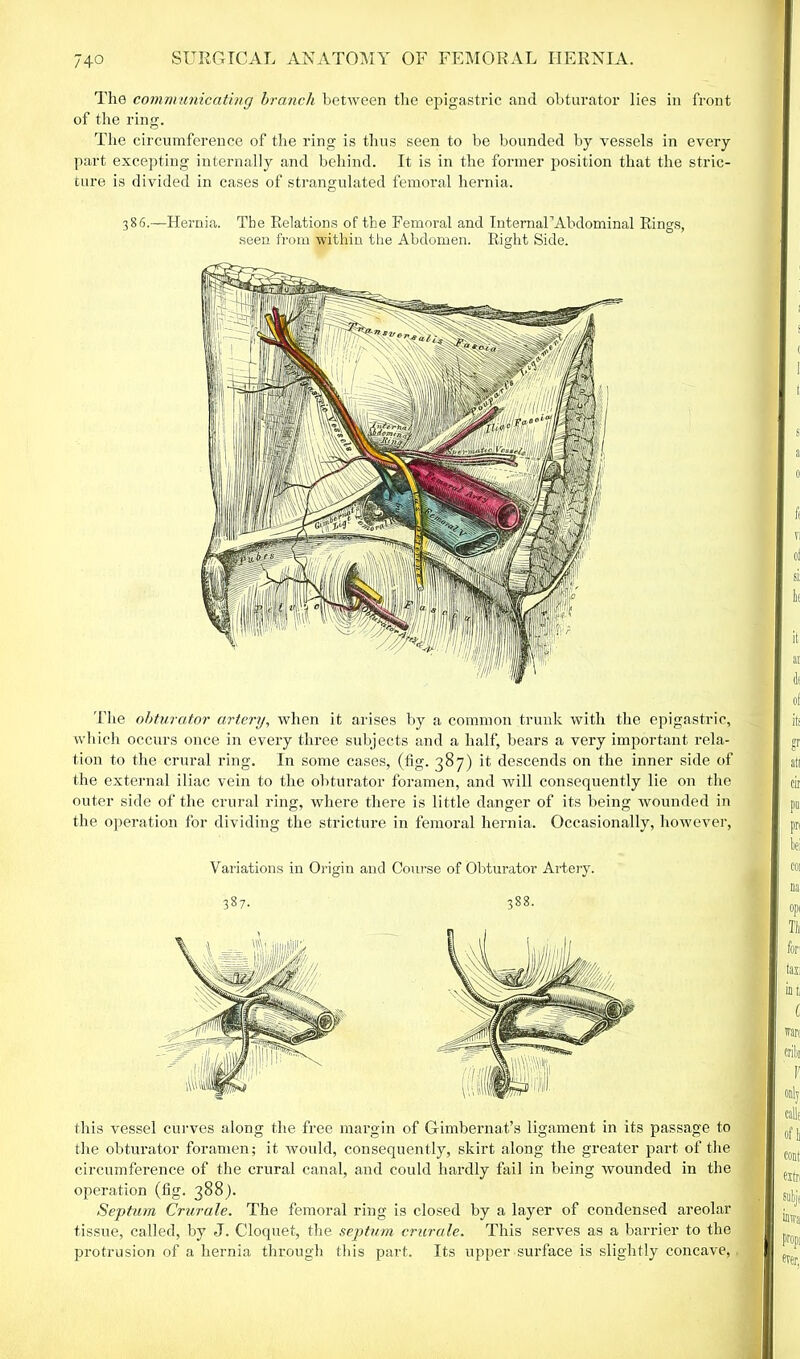 The communicating branch between the epigastric and obturator lies in front of the ring. The circumference of the ring is thus seen to be bounded by vessels in every part excepting internally and behind. It is in the former position that the stric- ture is divided in cases of strangulated femoral hernia. 386.—Hernia. Tbe Relations of the Femoral and IntemaFAbdominal Rings, seen from within the Abdomen. Right Side. The obturator artery, when it arises by a common trunk with the epigastric, which occurs once in every three subjects and a half, bears a very important rela- tion to the crural ring. In some cases, (fig. 387) it descends on the inner side of the external iliac vein to the obturator foramen, and will consequently lie on the outer side of the crural ring, where there is little danger of its being wounded in the operation for dividing the stricture in femoral hernia. Occasionally, however, Variations in Origin and Course of Obturator Artery. 387. 388. this vessel curves along the free margin of Gimbernat’s ligament in its passage to the obturator foramen; it would, consequently, skirt along the greater part of the circumference of the crural canal, and could hardly fail in being wounded in the operation (fig. 388). Septum Crurale. The femoral ring is closed by a layer of condensed areolar tissue, called, by J. Cloquet, the septum crurale. This serves as a barrier to the protrusion of a hernia through this part. Its upper surface is slightly concave,