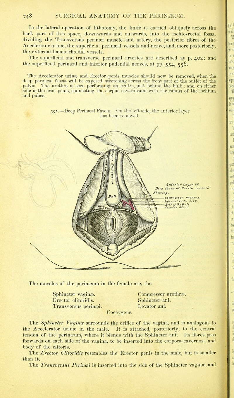 In the lateral operation of lithotomy, the knife is carried obliquely across the back part of this space, downwards and outwards, into the ischio-rectal fossa, dividing the Transversus perinsei muscle and artery, the posterior fibres of the Accelerator urinas, the superficial peri meal vessels and nerve, and, more posteriorly, the external haemorrhoidal vessels. The superficial and transverse peri meal arteries are described at p. 402; and the superficial perinceal and inferior pudendal nerves, at pp. 554, 556. The Accelerator urinse and Erector penis muscles should now be removed, when the deep perinseal fascia will be exposed, stretching across the front part of the outlet of the pelvis. The urethra is seen perforating its centre, just behind the bulb; and on either side is the crus penis, connecting the corpus cavernosum with the ramus of the ischium and pubes. 392.—Deep Perinteal Fascia. On the left side, the anterior layer has been removed. Antcric r Lay.er of Decji Perineal Pas dot removed Shewing, COMPRESSOR URETHR/t InternalPudic Arty. of the Bu.ll Corvpe Ps Gla nd The muscles of the peri me um in the female are, the Sphincter vaginae. Compressor urethra:. Erector clitoridis. Sphincter ani. Transversus perinasi. Levator ani. Coccygeus. The Sphincter Vagince surrounds the orifice of the vagina, and is analogous to the Accelerator urinas in the male. It is attached, posteriorly, to the central tendon of the perinasum, where it blends with the Sphincter ani. Its fibres pass forwards on each side of the vagina, to be inserted into the corpora cavernosa and body of the clitoris. The Erector Clitoridis resembles the Erector penis in the male, but is smaller than it. The Transversus Perincei is inserted into the side of the Sphincter vaginas, and