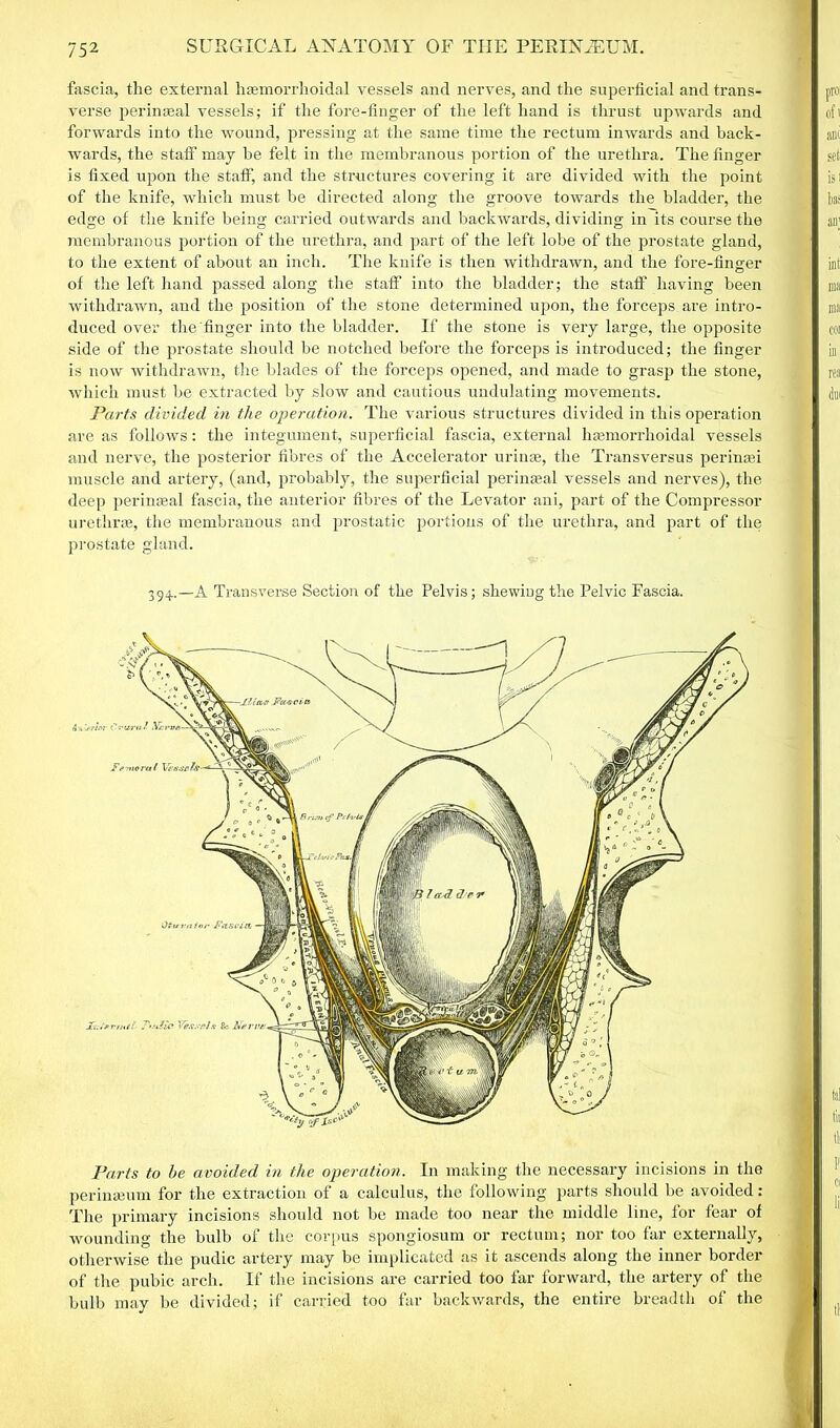 fascia, the external haemorrhoidal vessels and nerves, and the superficial and trans- verse perinseal vessels; if the fore-finger of the left hand is thrust upwards and forwards into the wound, pressing at the same time the rectum inwards and back- wards, the staff may he felt in the membranous portion of the urethra. The finger is fixed upon the staff, and the structures covering it are divided with the point of the knife, which must be directed along the groove towards the bladder, the edge of the knife being carried outwards and backwards, dividing in its course the membranous portion of the urethra, and part of the left lobe of the prostate gland, to the extent of about an inch. The knife is then withdrawn, and the fore-finger of the left hand passed along the staff into the bladder; the staff having been withdrawn, and the position of the stone determined upon, the forceps are intro- duced over the'finger into the bladder. If the stone is very large, the opposite side of the prostate should be notched before the forceps is introduced; the finger is now withdrawn, the blades of the forceps opened, and made to grasp the stone, which must be extracted by slow and cautious undulating movements. Parts divided in the operation. The various structures divided in this operation are as follows: the integument, superficial fascia, external hemorrhoidal vessels and nerve, the posterior fibres of the Accelerator urine, the Transversus perinasi muscle and artery, (and, probably, the superficial perineal vessels and nerves), the deep perineal fascia, the anterior fibres of the Levator ani, part of the Compressor urethre, the membranous and prostatic portions of the urethra, and part of the prostate gland. 394.—A Transverse Section of the Pelvis; shewing the Pelvic Fascia. Parts to be avoided in the operation. In making the necessary incisions in the perinamm for the extraction of a calculus, the following parts should be avoided: The primary incisions should not be made too near the middle line, for fear of wounding the bulb of the corpus spongiosum or rectum; nor too far externally, otherwise the pudic artery may be implicated as it ascends along the inner border of the pubic arch. If the incisions are carried too far forward, the artery of the bulb may be divided; if carried too far backwards, the entire breadth of the