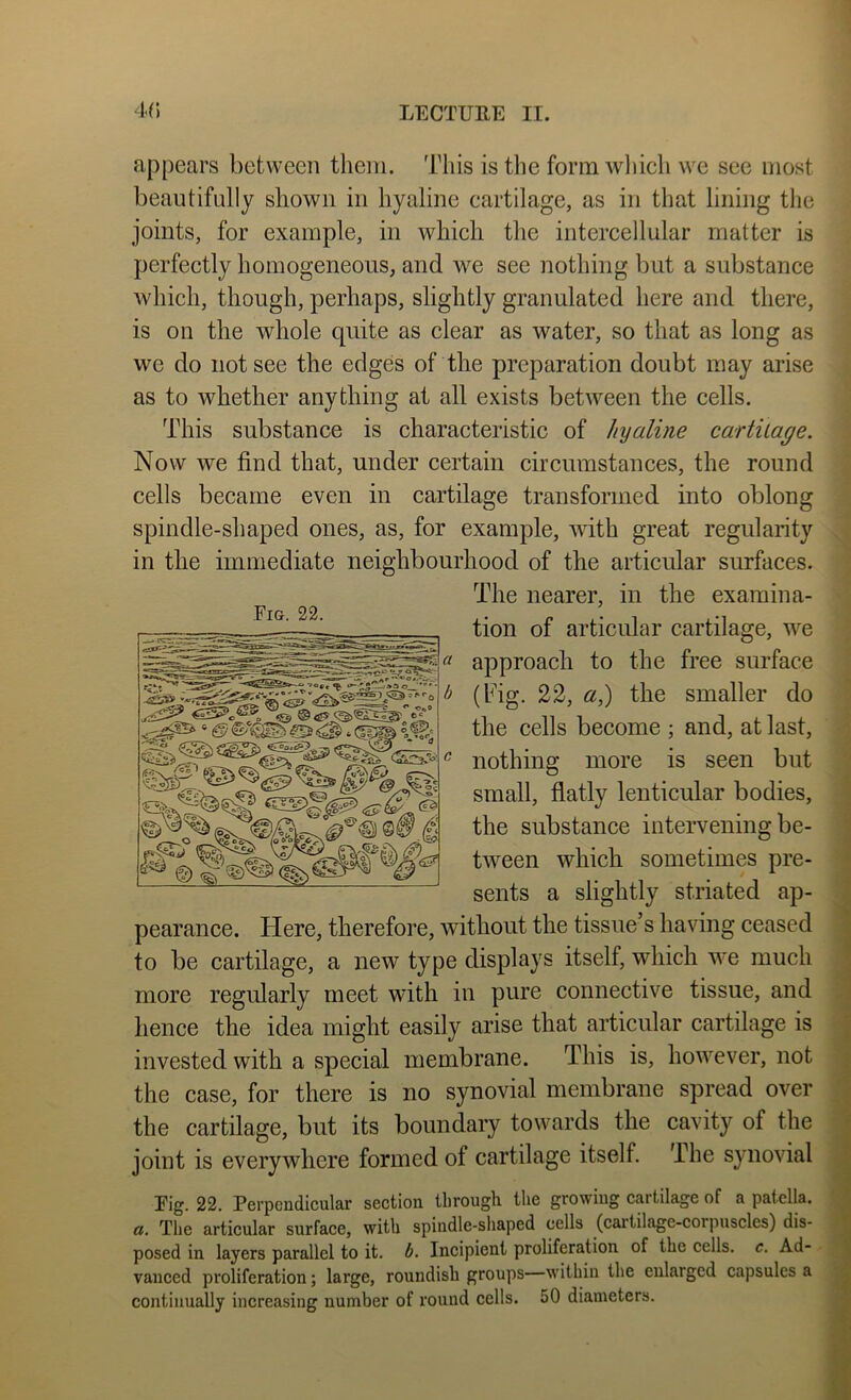 appears between them. This is the form wliich we see most beautifully shown in hyaline cartilage, as in that lining the joints, for example, in which the intercellular matter is perfectly homogeneous, and we see nothing but a substance which, though, perhaps, slightly granulated here and there, is on the whole quite as clear as water, so that as long as we do not see the edges of the preparation doubt may arise as to whether anything at all exists between the cells. This substance is characteristic of hyaline cartilage. Now we find that, under certain circumstances, the round cells became even in cartilage transformed into oblong spindle-shaped ones, as, for example, mth great regularity in the immediate neighbourhood of the articular surfaces. The nearer, in the examina- tion of articular cartilage, we ; approach to the free surface ■ b (big. 22, a^ the smaller do : the cells become ; and, at last, ^ nothing more is seen but small, flatly lenticular bodies, the substance intervening be- tween which sometimes pre- sents a slightly striated ap- pearance. Here, therefore, without the tissue’s having ceased to be cartilage, a new type displays itself, which we much more regularly meet with in pure connective tissue, and hence the idea might easily arise that articular cartilage is invested with a special membrane. This is, however, not the case, for there is no synovial membrane spread over the cartilage, but its boundary towards the cavity of the joint is everywhere formed of cartilage itself. The synovial Eig. 22. Perpendicular section through the growing cartilage of a patella. a. The articular surface, with spindle-shaped cells (cartilage-corpuscles) dis- posed in layers parallel to it. b. Incipient proliferation of the cells, c. Ad- - vaiiced proliferation; large, roundish groups—within the enlarged capsules a continually increasing number of round cells. 50 diameters.