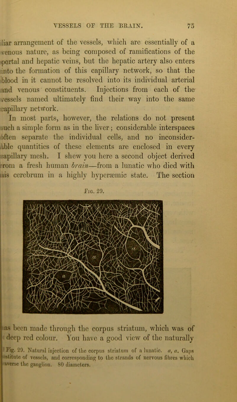 liar arrangement of the vessels, which are essentially of a venous nature, as being composed of ramifications of the portal and hepatic veins, but the hepatic artery also enters into the formation of this capillary network, so that the blood in it cannot be resolved into its individual arterial md venous constituents. Injections from each of the vessels named ultimately find their way into the same capillary network. In most parts, hoAvever, the relations do not present liucli a simple form as in the liver; considerable interspaces )ften separate the individual cells, and no inconsider- able quantities of these elements are enclosed in every ■.;apillary mesh. I shew you here a second object derived i rom a fresh human brain—from a lunatic who died with I lis cerebrum in a highly hypersemic state. The section Fig. 29. was been made through the corpus striatum, which was of deep red colour. You have a good view of the naturally ' Fig. 29. Natural injection of the corpus striatum of a lunatic, a, a. Gaps ■nstitute of vessels, and corresponding to the strands of nervous fibres which averse the ganglion. 80 diameters.