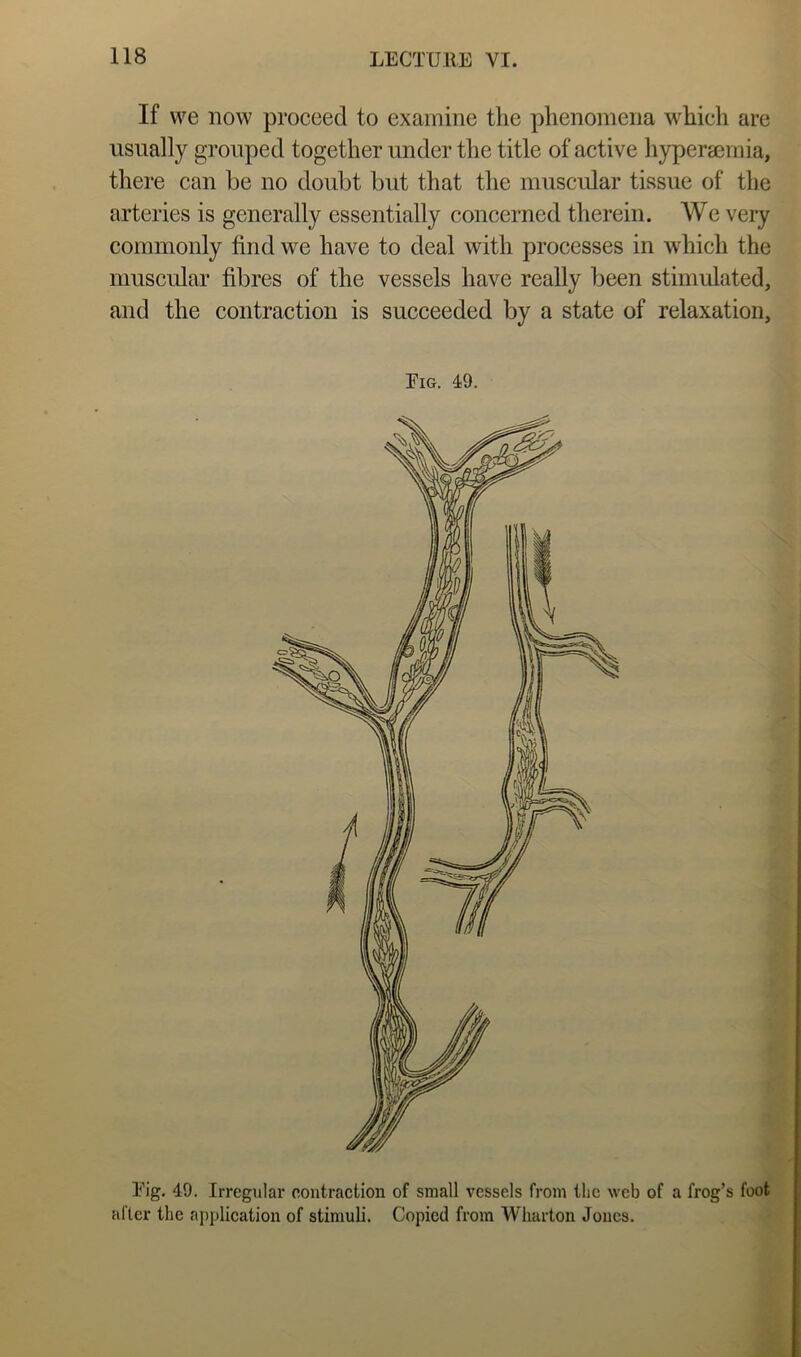 If vve now proceed to examine the phenomena which are usually grouped together under the title of active hyperaemia, there can be no doubt but that the muscidar tissue of the arteries is generally essentially concerned therein. We very commonly find we have to deal with processes in which the museular fibres of the vessels have really been stimulated, and the contraction is succeeded by a state of relaxation. Eig. 49. Eig. 49. Irregular contraction of small vessels from the web of a frog’s foot after the application of stimuli. Copied from Wharton Jones.