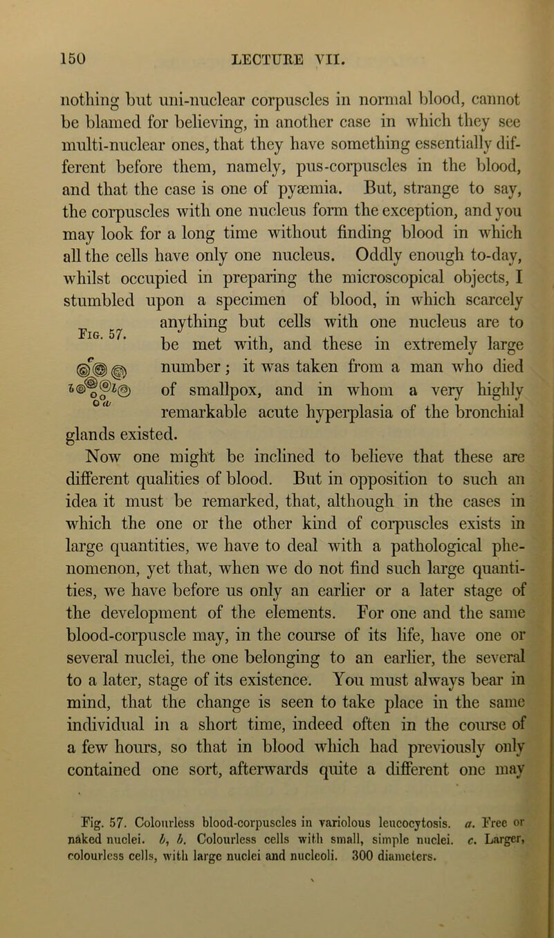 nothing but uni-nuclear corpuscles in normal Ijloocl, cannot be blamed for believing, in another case in which they see multi-nuclear ones, that they have something essentially dif- ferent before them, namely, pus-corpuscles in the blood, and that the case is one of pyaemia. But, strange to say, the corpuscles with one nucleus form the exception, and you may look for a long time without finding blood in which all the cells have only one nucleus. Oddly enough to-day, whilst occupied in preparing the microscopical objects, I stumbled upon a specimen of blood, in which scarcely anything but cells with one nucleus are to be met with, and these in extremely large nmnber; it was taken from a man who died of smallpox, and in whom a very highly remarkable acute hyperplasia of the bronchial glands existed. Now one might be inclined to believe that these are different qualities of blood. But in opposition to such an idea it must be remarked, that, although in the cases in which the one or the other kind of coi’puscles exists in large quantities, we have to deal with a pathological phe- nomenon, yet that, when we do not find such large quanti- ties, we have before us only an earlier or a later stage of the development of the elements. For one and the same blood-corpuscle may, in the course of its life, have one or several nuclei, the one belonging to an earlier, the several to a later, stage of its existence. You must always bear in mind, that the change is seen to take place in the same individual in a short time, indeed often in the course of a few hours, so that in blood which had previously only contained one sort, afterwards quite a different one may Eig. 57. A, 0(0 Eig. 57. Colourless blood-corpuscles in variolous leucocjtosis. a. Eree or naked nuclei, b, b. Colourless cells with small, simple nuclei, c. Larger, colourless cells, with large nuclei and nucleoli. 300 diameters.