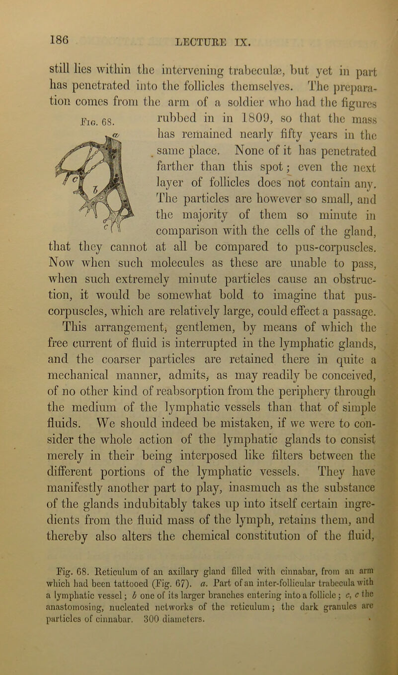 still lies within the intervening trabeculae, but yet in part has penetrated into the follicles themselves. The pre})ara- tion conies from the arm of a soldier \vho had the figures rubbed in in 1809, so that the mass has remained nearly fifty years in the same place. None of it has penetrated farther than this spot; even the next layer of follicles does not contain any. The particles are however so small, and the majority of them so minute in comparison with the cells of the gland, that they cannot at all be compared to pus-corpuscles. Now when such molecules as these are unable to pass, when such extremely minute particles cause an obstruc- tion, it would be somewhat bold to imagine that pus- corpuscles, which are relatively large, could effect a passage. This arrangement^ gentlemen, by means of which the free current of fluid is interrupted in the lymphatic glands, and the coarser particles are retained there in quite a mechanical manner, admits^ as may readily be conceived, of no other kind of reabsorption from the periphery through the medium of the lymphatic vessels than that of simple fluids. We should indeed be mistaken, if we were to con- sider the whole action of the lymphatic glands to consist merely in their being interposed like filters between the different portions of the lymphatic vessels. They have manifestly another part to play, inasmuch as the substance of the glands indubitably takes up into itself certain ingre- dients from the fluid mass of the lymph, retains them, and thereby also alters the chemical constitution of the fluid. Eig. 68. Fig. 68. Reticulum of an axillary gland filled with cinnabar, from an arm which had been tattooed (Fig. 67). a. Part of an inter-follicular trabecula with a lymphatic vessel; b one of its larger branches entering into a follicle; c. c the anastomosing, nucleated networks of the reticulum; the dark granules are particles of cinnabar. 300 diameters.