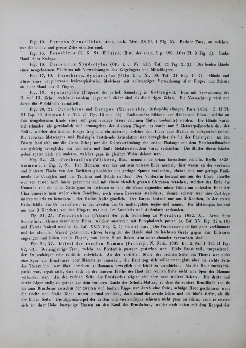 nur die kleine und grosse Zehe erhalten sind. Fig. 15. Perochirus (I. G. St. Hilaire, Hist, des anom. I p. 680. Atlas PI. 3 Fig. 1). Linke Hand eines Embryo. Fig. 16. Perochirus. Syndactylus (Otto 1. c. Nr. 547. Taf. 21 Fig. 2, 3). Die beiden Hände eines neugeborenen Mädchens mit Verwachsungen des Zeigefingers und Mittelfingers. Fig. 17, 18. Perochirus. Syndactylus (Otto 1. c. Nr. 68. Taf. 21 Fig. 4—7). Hände und Füsse eines neugeborenen hydrocephalischen Mädchens mit vollständiger Verwachsung aller Finger und Zehen; an einer Hand nur 3 Finger. Fig. 19. Syndactylus (Präparat der pathol. Sammlung in Göttingen). Fuss mit Verwachsung der II, und III. Zehe, welche ausserdem länger und dicker sind als die übrigen Zehen. Die Verwachsung wird nur durch die Weichtheilc vermittelt. Fig. 20, 21. Perochirus und Peropus (Maisonable, Orthopedie clinique. Paris 1834. T. II PI. III Cop. bei Ammon 1. c. Taf. 21 Fig. 15 und 18). Rudimentäre Bildung der Hände und Fiisse, welche an dem neugeborenen Kinde einer auf ganz analoge Weise deformen Mutter beobachtet wurden. Die Hände waren viel schmäler als gewöhnlich und ermangelten der 4 ersten Finger; es waren nur 2 Metacarpalknochen da, der fünfte, welcher den kleinen Finger trug und ein anderer, welcher dem Index oder Mcdius zu entsprechen schien. Die zwischen Metacarpus und Phalangus bestehende Arliculation war beweglicher als die der Phalangen. An den Füssen fand sich nur die kleine Zehe; nur die Gelenkverbindung der ersten Phalange mit dem Metatarsalknochen war gehörig beweglich; nur der erste und fünfte Metatarsalknochen waren vorhanden. Die Mutter dieses Kindes gebar später noch ein anderes, welches ganz in gleicher Weise deform war. Fig. 22, 23. Perobrachius (Wicbers, Diss. nonnulla de prima formatione cohibila. Berlin 1838. Ammon 1. c. Fig. 7, 8). Der Humerus war bis auf sein unteres Ende normal, hier waren an der vorderen und hinteren Fläche von den Cavitates glenoidales nur geringe Spuren vorhanden, ebenso sind nur geringe Rudi- mente der Condylen und der Trochlea und Rotula sichtbar. Der Vorderarm bestand nur aus der Ulna; dieselbe war von aussen nach innen gekrümmt und mit einem ziemlich grossen Olccranon versehen, welcher das Ende des Humerus von der einen Seite ganz zu umfassen schien; die Fossa sigmoidea minor fehlt; am untersten Ende der Ulna bemerkte man weder einen Condylus, noch einen Processus styloideus, ebenso schwer war eine Cartilago interarticularis zu bemerken. Der Radius fehlte gänzlich. Der Carpus bestand nur aus 5 Knochen, in der ersten Reihe fehlte das Os naviculare, in der zweiten das Os multangulum majus und minus. Der Metacarpus bestand nur aus 3 Knochen; von den Fingern war nur der Annularis und Auricularis vorhanden. Fig. 24, 25. Perobrachius (Präparat der path. Sammlung zu Würzburg 1082. X). Arme eines Smonatlichen kleinen männlichen Fötus, welcher ausserdem mit Encephalocele poster. (s. Taf. XV. Fig. 17 u. 18) und Hernia funiculi umbilic. (s. Taf. XXIV Fig. 3, 4) behaftet war. Die Vorderarme sind fast ganz verkümmert und im stumpfen Winkel gekrümmt, schwer beweglich, die Hände sind im höchsten Grade gegen den Unterarm angezogen und haben nur 4 Finger, von denen 2 am linken Arm unter einander verwachsen sind. Fig. 26, 27. Defect der rechten Mamma (Froriep, N. Notiz. 1839. Bd. X Nr. 1 Taf. II Fig. 62, 63). Dreissigjährigc Frau, welche an Peritonitis puerper. gestorben war. Linke Brust voll, turgcscirend, der Drüsenkörper sehr reichlich entwickelt. An der vertieften Stelle der rechten Seite des Thorax war nicht eine Spur von Brustwarze oder Mamma zu bemerken, die Haut zog sich vollkommen glatt über die rechte Seite des Thorax hin, war über derselben vollkommen beweglich und leicht zu verschieben. Als die Haut zurückprä- parirt war, ergab sich, dass auch an der inneren Fläche der Haut der rechten Seite nicht eine Spur der Mamma vorhanden war. An der rechten Seite des Brustkorbes zeigten sich aber noch weitere Defecte. Die dritte und vierte Rippe endigten gerade vor dem vorderen Rande des Schulterblattes, so dass die vordere Brusffläche von da bis zum Brustbeine zwischen der zweiten und fünften Rippe nur durch eine feste, sehnige Haut geschlossen war; die zweite und fünfte Rippe waren normal gebildet, doch stand die zweite höher und die fünfte tiefer, als die der linken Seite. Die Rippenknorpel der dritten und vierten Rippe schienen nicht ganz zu fehlen, denn es setzten sich in ihrer Höhe knorpelige Massen an den Rand des Brustbeines, welche nach unten mit dem Knorpel der