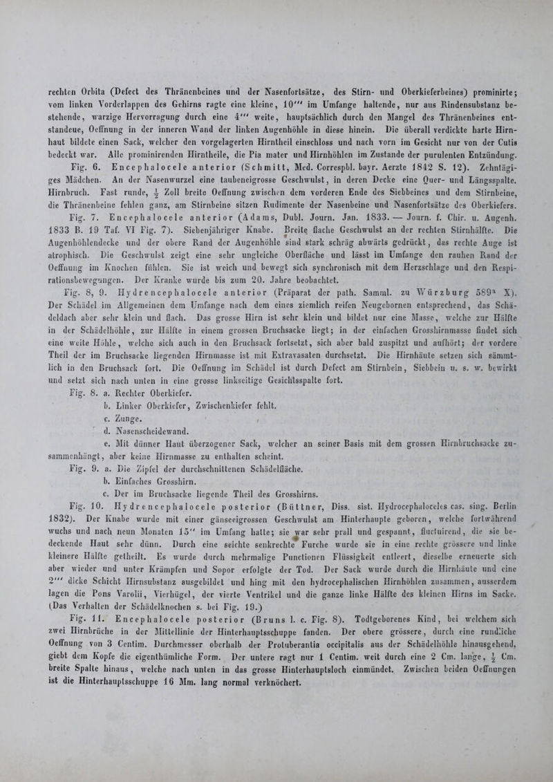 rechten Orbita (Defect des Thräncnbeincs und der Nasenfortsätze, des Stirn- und Oberkieferbeines) prominirte; vom linken Vordcrlappen des Gehirns ragte eine kleine, 10' im Umfange haltende, nur aus Pundensubstanz be- stehende, warzige Hervorragung durch eine 4' weite, hauptsächlich durch den Mangel de3 Thränenbeines ent- standene, Oeffnung in der inneren Wand der linken Augenhöhle in diese hinein. Die überall verdickte harte Hirn- haut bildete einen Sack, welcher den vorgelagerten Hirntheil einschloss und nach vorn im Gesicht nur von der Cutis bedeckt war. Alle prominirenden Hirniheile, die Pia mater und Hirnhöhlen im Zustande der purulenten Entzündung. Fig. 6. E n c e p h a 1 o c e 1 e anterior (Schmitt, Med. Corrcspbl. bayr. Aerztc 1842 S. 12). Zehntägi- ges Mädchen. An der Nasenwurzel eine taubeneigrosse Geschwulst, in deren Decke eine Quer- und Längsspaltc. Hirnbruch. Fast runde, i Zoll breite Oeffnung zwischen dem vorderen Ende des Siebbeines und dem Stirnbeine, die Thränenbeine fehlen ganz, am Stirnbeine sitzen Rudiment« der Nasenbeine und Nasenfortsätze des Oberkiefers. Fig. 7. E n c ep h a 1 o ce 1 e anterior (Adams, Dubl. Journ. Jan. 1833.— Jonrn. f. Cliir. u. Augenh. 1833 P>. 19 Taf. VI Fig. 7). Siebenjähriger Knabe. Breite flache Geschwulst an der rechten Stirnhälfte. Die Augenhöhlendeckc und der obere Rand der Augenhöhle sind stark schräg abwärts gedrückt, das rechte Auge ist atrophisch. Die Geschwulst zeigt eine sehr ungleiche Oberfläche und lässt im Umfange den rauhen Rand der Oeffnung im Knochen fühlen. Sie ist weich und bewegt sich synchronisch mit dem Herzschlage und den Respi- rationsbewegungen. Der Kranke wurde bis zum 20. Jahre beobachtet. Fig. 8, 9. Hydrencephalocele anterior (Präparat der path. Samml. zu Würzburg 589a X). Der Schädel im Allgemeinen dem Umfange nach dem eines ziemlich reifen Ncugcbornen entsprechend, das Schä- deldach aber sehr klein und flach. Das grosse Hirn ist sehr klein und bildet nur eine Masse, welche zur Hälfte in der Schädelhöhle, zur Hälfte in einem grossen Bruchsacke liegt; in der einfachen Grosshirnmassc findet sich eine weite Höhle, welche sich auch in den Bruchsack fortsetzt, sich aber bald zuspitzt und aufhört; der vordere Theil der im Bruchsacke liegenden Hirnmassc ist mit Extravasaten durchsetzt. Die Hirnhäute setzen sich sämmt- lich in den Bruchsack fort. Die Oeffnung im Schädel ist durch Defect am Stirnbein, Siebbciu u. s. w. bewirkt und setzt sich nach unten in eine grosse linkscitige Gesichtsspalte fort. Fig. 8. a. Pachter Oberkiefer. b. Linker Oberkiefer, Zwischenkiefer fehlt. c. Zunge. 1 , d. Nasenscheidewand. e. Mit dünner Haut überzogener Sack, welcher an seiner Basis mit dem grossen Hirnbruchsacke zu- sammenhängt, aber keine Hirnmasse zu enthalten scheint. Fig. 9. a. Die Zipfel der durchschnittenen Schädelfläche. b. Einfaches Grosshirn. c. Der im Bruchsacke liegende Theil des Grosshirns. Fig. 10. Hydren cephalocele posterior (Büttner, Diss. sist. Hydrocephaloceles cas. sing. Berlin 1832). Der Knabe wurde mit einer gänsceigrossen Geschwulst am Hinterhaupte geboren, welche fortwährend wuchs und nach neun Monaten 15 im Umfang hatte; sic war sehr prall und gespannt, fluctuircnd, die sie be- deckende Haut sehr dünn. Durch eine seichte senkrechte Furche wurde sie in eine rechte grössere und linke kleinere Hälfte getheilt. Es wurde durch mehrmalige Punctioncn Flüssigkeit entleert, dieselbe erneuerte sich aber wieder und unter Krämpfen und Sopor erfolgte der Tod. Der Sack wurde durch die Hirnhäute und eine 2' dicke Schicht Hirnsubstanz ausgcbildct und hing mit den hydrocephalischen Hirnhöhlen zusammen, ausserdem lagen die Pons Varolii, Vierhügel, der vierte Ventrikel und die ganze linke Hälfte des kleinen Hirns im Sacke. (Das Verhalten der Schädelknochen s. bei Fig. 19.) Fig. 11. En cephalocele posterior (Bruns 1. c. Fig. 8). Todtgeborcnes Kind, bei welchem sich zwei Hirnbrüche in der Mittellinie der Hintcrhauptsschuppe fanden. Der obere grössere, durch eine rundliche Oeffnung von 3 G'entim. Durchmesser oberhalb der Protuberanlia occipitalis aus der Schädelhöhle hinausgehend, giebt dem Kopfe die eigenthiimliche Form. Der untere ragt nur 1 Centim. weit durch eine 2 Cm. lange, \ Cm. breite Spalte hinaus , welche nach unten in das grosse Hinterhauptsloch einmündet. Zwischen beiden Oeffnungen