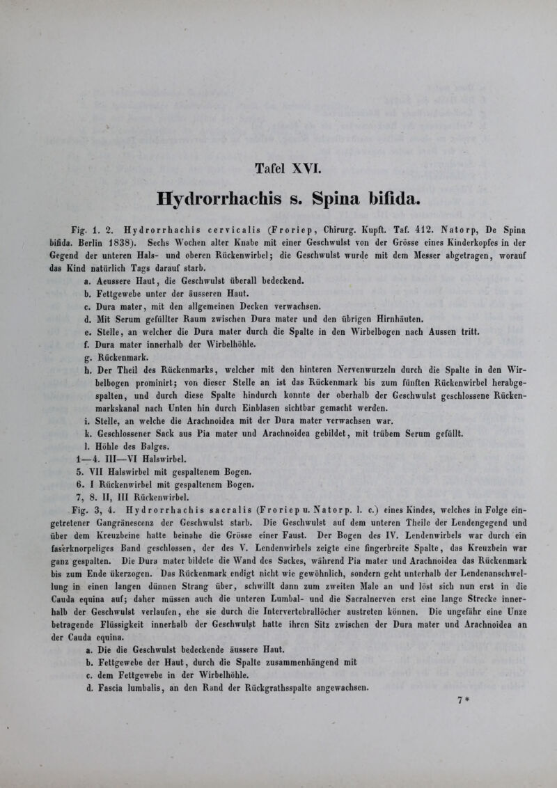 Hyclrorrhachis s. Spina bifida. Fig. 1. 2. Hydrorrhachis cervicalis (Froriep, Chirurg. Kupft. Taf. 412. Natorp, De Spina bifida. Berlin 1838). Sechs Wochen alter Knabe mit einer Geschwulst von der Grösse eines Kinderkopfes in der Gegend der unteren Hals- und oberen Rückenwirbel; die Geschwulst wurde mit dem Messer abgetragen, worauf das Kind natürlich Tags darauf starb. a. Aeussere Haut, die Geschwulst überall bedeckend. b. Fettgewebe unter der äusseren Haut. c. Dura matcr, mit den allgemeinen Decken verwachsen. d. Mit Serum gefüllter Raum zwischen Dura mater und den übrigen Hirnhäuten. e. Stelle, an welcher die Dura mater durch die Spalte in den Wirbelbogcn nach Aussen tritt. f. Dura mater innerhalb der Wirbelhöhle. g. Rückenmark. h. Der Theil des Rückenmarks, welcher mit den hinteren Nervenwurzeln durch die Spalte in den Wir- belbogen prominirt; von dieser Stelle an ist das Rückenmark bis zum fünften Rückenwirbel herabge- spalten, und durch diese Spalte hindurch konnte der oberhalb der Geschwulst geschlossene Rücken- markskanal nach Unten hin durch Einblasen sichtbar gemacht werden. i. Stelle, an welche die Arachnoidca mit der Dura mater verwachsen war. k. Geschlossener Sack aus Pia mater und Arachnoidca gebildet, mit trübem Serum gefüllt. l. Höhle des Balges. 1—4. III—VI Halswirbel. 5. VII Halswirbel mit gespaltenem Bogen. 6. I Rückenwirbel mit gespaltenem Bogen. 7. 8. II, III Rückenwirbel. Fig. 3, 4. Hydrorrhachis sacralis (Froriep u. Natorp. 1. c.) eines Kindes, welches in Folge ein- getretener Gangräncscenz der Geschwulst starb. Die Geschwulst auf dem unteren Theile der Lendengegend und über dem Kreuzbeine hatte beinahe die Grösse einer Faust. Der Bogen des IV. Lendenwirbels war durch ein fas'erknorpeliges Band geschlossen, der des V. Lendenwirbels zeigte eine fingerbreite Spalte, das Kreuzbein war ganz gespalten. Die Dura mater bildete die Wand des Sackes, während Pia mater und Arachnoidea das Rückenmark bis zum Ende überzogen. Das Rückenmark endigt nicht wie gewöhnlich, sondern geht unterhalb der Lendcnanschwel- lung in einen langen dünnen Strang über, schwillt dann zum zweiten Male an und löst sich nun erst in die Cauda equina auf; daher müssen auch die unteren Lumbal- und die Sacralnervcn erst eine lange Strecke inner- halb der Geschwulst verlaufen, ehe sie durch die Intervertebrallöcher austreten können. Die ungefähr eine Unze betragende Flüssigkeit innerhalb der Geschwulst halte ihren Sitz zwischen der Dura mater und Arachnoidea an der Cauda equina. a. Die die Geschwulst bedeckende äussere Haut. b. Fettgewebe der Haut, durch die Spalte zusammenhängend mit c. dem Fettgewebe in der Wirbelhöhle. d. Fascia lumbalis, an den Rand der Rückgrathsspalte angewachsen. 7*