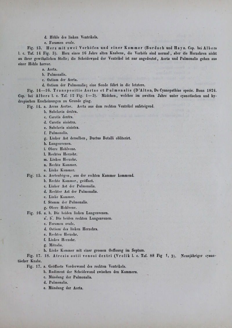 e. Foramen ovale. Fig. 13. Herz mit zwei Vorhöfen und einer Kammer (Burdach und Hayn. Cop. bei Albers 1. c. Taf. 14 Fig. 3). Herz eines 16 Jahre alten Knabens, die Vorhöfe sind normal, aber die Herzohren nicht an ihrer gewöhnlichen Stelle; die Scheidewand der Ventrikel ist nur angedeutet, Aorta und Pulmonalis gehen aus einer Höhle hervor. a. Aorta. b. Pulmonalis. c. Ostium der Aorta. d. Ostium der Pulmonalis; eine Sonde führt in die letztere. Fig. 14—16. T r a n s p o s i t i o Ao rta e et Pulmonalis (D ’Alt o n, De Cyanopathiae specie. Bonn 1824. Cop. bei Albers 1. c. Taf. 12 Fig. 1 — 3). Mädchen, welches im zweiten Jahre unter cyanotischen und hy- dropischen Erscheinungen zu Grunde ging. Fig. 14. a. Arcus Aortae. Aorta aus dem rechten Ventrikel aufsteigend. b. Subclavia dextra. c. Carotis dextra. d. Carotis sinistra. e. Subclavia sinistra. f. Pulmonolis. \ g. Linker Ast derselben, Ductus Botalli obliterirt. h. Lungenvenen. i. Obere Hohlvene. l. Rechtes Herzohr. m. Linkes Herzohr. u. Rechte Kammer, o. Linke Kammer. Fig. 15. a. Aortenbögen, aus der rechten Kammer kommend. b. Rechte Kammer, geöffnet. c. Linker Ast der Pulmonalis. d. Rechter Ast der Pulmonalis. e. Linke Kammer. f. Stamm der Pulmonalis. g. Obere Hohlvene. Fig. 16. a. b. Die beiden linken Lungenvenen. a\ b\ Die beiden rechten Lungenvenen. c. Foramen ovale. d. Ostium des linken Herzohrs. e. Rechtes Herzohr. f. Linkes Herzohr. g. Mitralis. h. Linke Kammer mit einer grossen Oeffnung im Septum. Fig. 17. 18. Atresia ostii venosi dextri (Vrolik 1. c. Taf. 88 Fig 1, 3). Neunjähriger cyauo- tischer Knabe. Fig. 17. a. Geöffnete Vorderwand des rechten Ventrikels. b. Rudiment der Scheidewand zwischen den Kammern. c. Mündung der Pulmonalis. d. Pulmonalis. e. Mündung der Aorta.