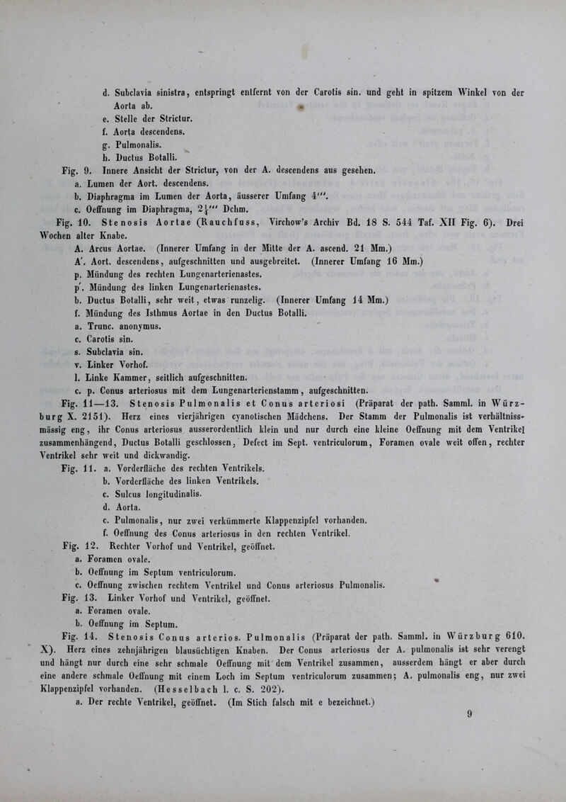 Aorta ab. e. Stelle der Strictur. f. Aorta descendens. g. Pulmonalis. h. Ductus Botalli. Fig. 9. Innere Ansicht der Strictur, von der A. descendens aus gesehen. a. Lumen der Aort. descendens. b. Diaphragma im Lumen der Aorta, äusserer Umfang 4'. c. Oeffnung im Diaphragma, 2^' Dehrn. Fig, 10. Stenosis Aortae (Rauchfuss, Virchow’s Archiv Bd. 18 S. 544 Taf. XII Fig. 6). Drei Wochen alter Knabe. A. Arcus Aortae. (Innerer Umfang in der Mitte der A. ascend. 21 Mm.) A'. Aort. descendens, aufgeschnitten und ausgebreitet. (Innerer Umfang 16 Mm.) р. Mündung des rechten Lungenarterienastes. p\ Mündung des linken Lungenarterienastes. b. Ductus Botalli, sehr weit, etwas runzelig. (Innerer Umfang 14 Mm.) f. Mündung des Isthmus Aortae in den Ductus Botalli. a. Trunc. anonymus. с. Carotis sin. s. Subclavia sin. v. Linker Vorhof. 1. Linke Kammer, seitlich aufgeschnitten. c. p. Conus artcriosus mit dem Lungenarterienstamm, aufgeschnitten. Fig. 11—13. Stenosis Pulmonalis et Conus arteriosi (Präparat der path. Samml. in Würz- burg X. 2151). Herz eines vierjährigen cyanotischen Mädchens. Der Stamm der Pulmonalis ist verhältniss- mässig eng, ihr Conus arteriosus ausserordentlich klein und nur durch eine kleine Oeffnung mit dem Ventrikel zusammenhängend, Ductus Botalli geschlossen. Defect im Sept. vcntriculorum, Foramen ovale weit offen, rechter Ventrikel sehr weit und dickwandig. Fig. 11. a. Vorderfläche des rechten Ventrikels. b. Vorderfläche des linken Ventrikels. c. Sulcus longitudinalis. d. Aorta. c. Pulmonalis, nur zwei verkümmerte Klappcnzipfel vorhanden, f. Oeffnung des Conus arteriosus in den rechten Ventrikel. Fig. 12. Rechter Vorhof und Ventrikel, geöffnet. a. Foramen ovale. b. Oeffnung im Septum ventriculorum. c. Oeffnung zwischen rechtem Ventrikel und Conus arteriosus Pulmonalis. Fig. 13. Linker Vorhof und Ventrikel, geöffnet. a. Foramen ovale. b. Oeffnung im Septum. Fig. 14. Stenosis Conus arteriös. Pulmonalis (Präparat der path. Samml. in Würzburg 610. X). Herz eines zehnjährigen blausüchtigen Knaben. Der Conus arteriosus der A. pulmonalis ist sehr verengt und hängt nur durch eine sehr schmale Oeffnung mit dem Ventrikel zusammen, ausserdem hängt er aber durch eine andere schmale Oeffnung mit einem Loch im Septum ventriculorum zusammen; A. pulmonalis eng, nur zwei Klappenzipfel vorhanden. (Hesselbach 1. c. S. 202). a. Der rechte Ventrikel, geöffnet. (Im Stich falsch mit e bezeichnet.) 9