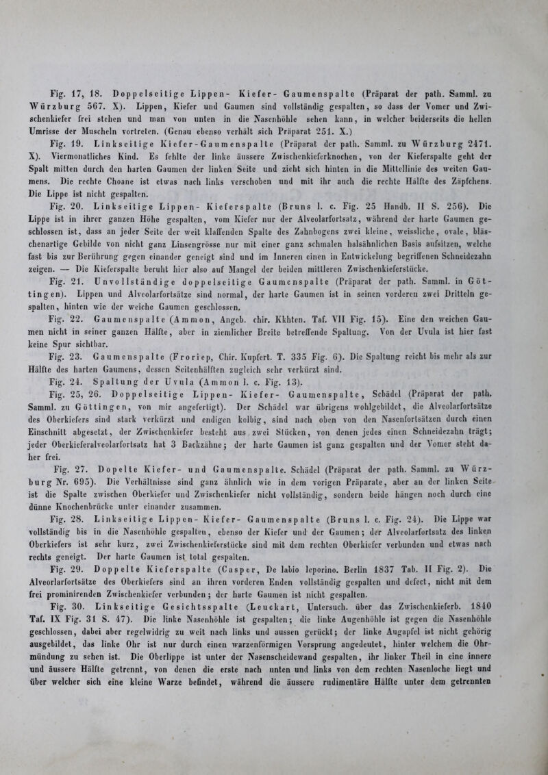 Fig. 17, 18. Doppelseitige Lippen- Kiefer- Gaumenspalte (Präparat der path. Samml. zu Würz bürg 567. X). Lippen, Kiefer und Gaumen sind vollständig gespalten, so dass der Vomer und Zwi- schenkiefer frei stehen und man von unten in die Nasenhöhle sehen kann, in welcher beiderseits die heilen Umrisse der Muscheln vortreten. (Genau ebenso verhält sich Präparat 251. X.) Fig. 19. Linkseitige Kiefer-Gaumenspalte (Präparat der path. Samml. zu Würz bürg 2471. X). Viermonatliches Kind. Es fehlte der linke äussere Zwischenkieferknochen, von der Kieferspalte geht der Spalt mitten durch den harten Gaumen der linken Seite und zieht sich hinten in die Mittellinie des weiten Gau- mens. Die rechte Choane ist etwas nach links verschoben und mit ihr auch die rechte Hälfte des Zäpfchens. Die Lippe ist nicht gespalten. Fig. 20. Linkseitige Lippen- Kieferspalte (Bruns 1. c. Fig. 25 Ifandb. II S. 256). Die Lippe ist in ihrer ganzen Höhe gespalten, vom Kiefer nur der Alveolarfortsatz, während der harte Gaumen ge- schlossen ist, dass an jeder Seite der weit klaffenden Spalte des Zahnbogens zwei kleine, wcissliche, ovale, bläs- chenartige Gebilde von nicht ganz Linsengrösse nur mit einer ganz schmalen halsähnlichen Basis aufsitzen, welche fast bis zur Berührung gegen einander geneigt sind und im Inneren einen in Entwickelung begriffenen Schneidezahn zeigen. — Die Kieferspalte beruht hier also auf Mangel der beiden mittleren Zwischenkieferstückc. Fig. 21. Unvollständige doppelseitige Gaumenspalte (Präparat der path. Samml. in Göt- tingen). Lippen und Alveolarfortsätze sind normal, der harte Gaumen ist in seinen vorderen zwei Dritteln ge- spalten, hinten wie der weiche Gaumen geschlossen. Fig. 22. Gaumenspalte (Ammon, Angeb. chir. Klchten. Taf. YII Fig. 15). Eine den weichen Gau- men nicht in seiner ganzen Hälfte, aber in ziemlicher Breite betreffende Spaltung. Von der Uvula ist hier fast keine Spur sichtbar. Fig. 23. Gaumenspalte (Froriep, Chir. Kupfert. T. 335 Fig. 6). Die Spaltung reicht bis mehr ah zur Hälfte des harten Gaumens, dessen Scitenhälften zugleich sehr verkürzt sind. Fig. 24. Spaltung der Uvula (Ammon 1. c. Fig. 13). Fig. 25, 26. Doppelseitige Lippen- Kiefer- Gaumenspalte, Schädel (Präparat der path. Samml. zu Göttin gen, von mir angefertigt). Der Schädel war übrigens wohlgebildet, die Alveolarfortsätze des Oberkiefers sind stark verkürzt und endigen kolbig, sind nach oben von den Nasenfortsätzen durch einen Einschnitt abgesetzt, der Zwischenkiefer besteht aus zwei Stücken, von denen jedes einen Schneidezahn trägt; jeder Oberkieferalveolarfortsatz hat 3 Backzähne; der harte Gaumen ist ganz gespalten und der \omer steht da- her frei. Fig. 27. Dopclte Kiefer- und Gaumenspalte. Schädel (Präparat der path. Samml. zu Würz- burg Nr. 695). Die Verhältnisse sind ganz ähnlich wie in dem vorigen Präparate, aber an der linken Seite ist die Spalte zwischen Oberkiefer und Zwischeukiefer nicht vollständig, sondern beide hängen noch durch eine dünne Ivnochenbrückc unter einander zusammen. Fig. 28. Linkseitige Lippen- Kiefer- Gaumenspalte (Bruns 1. c. Fig. 24). Die Lippe war vollständig bis in die Nasenhöhle gespalten, ebenso der Kiefer und der Gaumen; der Alvcolarfortsatz des linken Oberkiefers ist sehr kurz, zwei Zwischenkieferstücke sind mit dem rechten Oberkiefer verbunden und etwas nach rechts geneigt. Der harte Gaumen ist total gespalten. Fig. 29. Doppelte Kieferspalte (Casper, De labio leporino. Berlin 1837 Tab. II Fig. 2). Die Alveorlarfortsätzc des Oberkiefers sind an ihren vorderen Enden vollständig gespalten und defect, nicht mit dem frei prominirenden Zwischenkiefer verbunden ; der harte Gaumen ist nicht gespalten. Fig. 30. Linkseitige Gcsichtsspaltc (Leuckart, Untersuch, über das Zwischcnkieferb. 1840 Taf. IX Fig. 31 S. 47). Die linke Nasenhöhle ist gespalten; die linke Augenhöhle ist gegen die Nasenhöhle geschlossen, dabei aber regelwidrig zu weit nach links und aussen gerückt; der linke Augapfel ist nicht gehörig ausgebildet, das linke Ohr ist nur durch einen warzenförmigen Vorsprung angedeutet, hinter welchem die Ohr- mündung zu sehen ist. Die Oberlippe ist unter der Nasenscheidewand gespalten, ihr linker Theil in eine innere und äussere Hälfte getrennt, von denen die erste nach unten und links von dem rechten Nasenloche liegt und über welcher sich eine kleine Warze befindet, während die äussere rudimentäre Hälfte unter dem getrennten