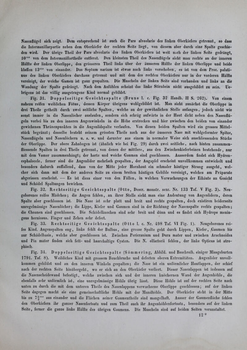 Nasenflügel sich zeigt. Dem entsprechend ist auch die Pars alveolaris des linken Oberkiefers getrennt, so dass die Intermaxillarparlie neben dem Oberkiefer der rechten Seite liegt, von diesem aber durch eine Spalte geschie- den wird. Der übrige Thcil der Pars alveolaris des linken Oberkiefers ist weit nach der linken Seite gedrängt, 10' von dem Intermaxiilartheile entfernt. Den kleinsten Theil des Nasenflügels sieht man rechts an der inneren Hälfte der linken Oberlippe, den grösseren Theil links über der äusseren Hälfte der linken Oberlippe und beide klaffen 13' von einander. Das Septum narium ist etwas nach links verschoben, cs ist von dem Proc. palati- nus des linken Oberkiefers durchaus getrennt uud mit dem des rechten Oberkiefers nur in der vorderen Hälfte vereinigt, der weiche Garnen ist gauz gespalten. Die Muscheln der linken Seite sind vorhanden und links an die Wandung der Spalte gedrängt. Nach dem Anfühlen scheint das linke Stirnbein nicht ausgebildct zu sein. Ue- brigens ist das völlig ausgelragene Kind normal gebildet. Fig. 31. Doppelseitige Ge sich t s sp a 11 e (Bruns 1. c. Fig. 32 Handb. II S. 262). Von einem nahezu reifen weiblichen Fötus, dessen Körper übrigens wohlgebildet ist. Man sieht zunächst die Oberlippe in drei Theile getheilt durch zwei seitliche Spalten, welche an der gewöhnlichen Stelle anfangen, jedoch nicht wie sonst immer in die Nasenlöcher auslaufen, sondern sich schräg aufwärts in der Haut dicht neben den Nasenflü- geln vorbei bis zu den inneren Augenwinkeln in die Höhe erstrecken und hier zwischen den beiden von einander gewichenen Thränenpunkten in die Augenlidspalte verlaufen. Von diesen beiden Spalten wird ein grosses Mittel- stück begränzt; dasselbe besteht seinem grössten Theile nach aus der äusseren Nase mit wohlgeformter Spitze, Nasenflügeln und Nasenlöchern u. s. w. und darunter aus einem in normaler Weise sich anschliessenden Stücke der Oberlippe. Der obere Zahnbogen ist (ähnlich wie bei Fig. 29) durch zwei seitliche, nach hinten zusainmen- fliessende Spalten in drei Theile getrennt, von denen der mittlere, aus den Zwischenkieferbeinen bestehende, nur mit dem Vomer zusammenhängt; der harte und weiche Gaumen sind geschlossen. Ausserdem findet sich Hydren- cephalocele, ferner sind die Augenlider mehrfach gespalten, der Augapfel erscheint unvollkommen entwickelt und besonders dadurch auffallend, dass von der Mitte jeder Hornhaut ein schmaler häutiger Strang ausgeht, wel- cher sich dann mit dem der anderen Seite zu einem breiten häutigen Gebilde vereinigt, welches am Präparate abgerissen erscheint. — Es ist diess einer von den Fällen, in welchen Verwachsungen der Eihäute an Gesicht und Schädel Spaltungen bewirken. Fig. 32. Rechlseitige Gesichtsspalte (Otto, Descr. monstr. scxc. Nr. 133 Taf. V Fig. 3). Neu- geborenes reifes Mädchen; die Augen fehlen, an ihrer Stelle sieht man eine Andeutung von Augenlidern, deren Spalte aber geschlossen ist. Die Nase ist sehr platt und breit und rechts gespalten, doch existiren beiderseits unregelmässige Nasenlöcher; die Lippe, Kiefer und Gaumen sind in der Richtung der Nasenspalte rechts gespalten; die Choanen sind geschlossen. Die Schädelknochen sind sehr breit und dünn und es findet sich Hydrops menin- geus herniosus. Finger und Zehen sehr defect. Fig. 33. Rechtseitige G e s ich ts s p a 11 e (Otto 1. c. Nr. 498 Taf. VI Fig. 1). Neugeborenes rei- fes Kind. Augenspalten eng, links fehlt der Bulbus, eine grosse Spalte geht durch Lippen, Kiefer, Gaumen bis zur Schädelbasis, welche aber geschlossen ist. Zwischen Pericranium und Dura mater und zwischen Arachnoidea und Pia mater finden sich fett- und haarchaltige Cysten. Die N. olfactorii fehlen, der linke Opticus ist atro- phisch. Fig. 34. Doppelseitige Gcsichtsspalte (Sömmering, Abbild, und Beschreib, einiger Missgeburten 1791. Taf. 8). Weibliches Kind mit grossem Bauchbruche und defecten oberen Extremitäten. Augenlider unvoll- kommen gebildet und an den inneren Winkeln gespalten; die Nase ist ein unförmlicher Hautlappen, der schief nach der rechten Seite hinübergeht, wo er sich an den Oberkiefer verliert. Dieser Nasenlappen ist indessen auf die Nasenscheidewand befestigt, welche zwischen sich und der inneren knöchernen Wand der Augenhöhle, die ebenfalls sehr unförmlich ist, eine unregelmässige Höhle übrig lässt. Diese Höhle ist auf der rechten Seite nach unten zu durch die mit dem unteren Theile des Nasenlappens verwachsene Oberlippe geschlossen; auf der linken Seite dagegen macht sie eine gemeinschaftliche Höhle mit der Mundhöhle. Der Oberkiefer steht in der Mitte bis zu 1\“' aus einander und die Flächen seiner Gaumenlheile sind mangelhaft. Ausser der Gaumenfläche fehlen den Oberkiefern ihr ganzer Nasenfortsatz uud zum Theil auch ihr Augenhöhlenfortsatz, besonders auf der linken Seite, ferner die ganze linke Hälfte des übrigen Gaumens. Die Muscheln sind auf beiden Seiten verunstaltet. 12 *