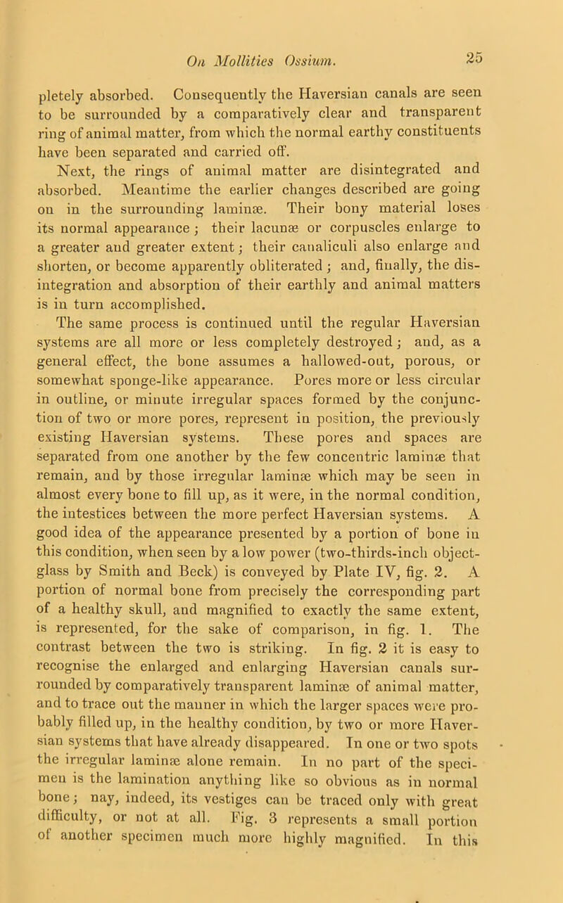 pletely absorbed. Consequently the Haversian canals are seen to be surrounded by a comparatively clear and transparent ring of animal matter, from which the normal earthy constituents have been separated and carried off. Next, the rings of animal matter are disintegrated and absorbed. Meantime the earlier changes described are going on in the surrounding laminae. Their bony material loses its normal appearance ; their lacunae or corpuscles enlarge to a greater and greater extent; their catialiculi also enlarge and shorten, or become apparently obliterated ; and, finally, the dis- integration and absorption of their earthly and animal matters is in turn accomplished. The same process is continued until the regular Haversian systems are all more or less completely destroyed; and, as a general effect, the bone assumes a hallowed-out, porous, or somewhat sponge-like appearance. Pores more or less circular in outline, or minute irregular spaces formed by the conjunc- tion of two or more pores, represent in position, the previously existing Haversian systems. These pores and spaces are separated from one another by the few concentric laminm that remain, and by those irregular laminse which may be seen in almost every bone to fill up, as it were, in the normal condition, the iutestices between the more perfect Haversian systems. A good idea of the appearance presented by a portion of bone in this condition, when seen by a low power (two-thirds-inch object- glass by Smith and Beck) is conveyed by Plate IV, fig. 2. A portion of normal bone from precisely the corresponding part of a healthy skull, and magnified to exactly the same extent, is represented, for the sake of comparison, in fig. 1. The contrast between the two is striking. In fig. 2 it is easy to recognise the enlarged and enlarging Haversian canals sur- rounded by comparatively transparent laminse of animal matter, and to trace out the manner in which the larger spaces were pro- bably filled up, in the healthy condition, by two or more Haver- sian systems that have already disappeared. In one or two spots the irregular laminse alone remain. In no part of the speci- men is the lamination anything like so obvious as in normal bone; nay, indeed, its vestiges can be traced only with great difficulty, or not at all. Fig. 3 represents a small portion of another specimen much more highly magnified. In this
