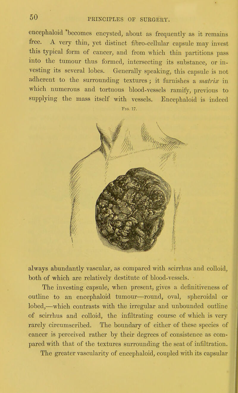 PRINCIPLES OF SURGERY. encephaloid becomes encysted, about as frequently as it remains free. A very thin, yet distinct fibro-cellular capsule may invest this typical form of cancer, and from 'wbicli thin partitions pass into the tumour thus formed, intersecting its substance, or in- vesting its several lobes. Generally speaking, this capsule is not adherent to the surrounding textures; it furnishes a matrix in which numerous and tortuous blood-vessels ramify, previous to supplying the mass itself with vessels. Encephaloid is indeed Vrs. 17. always abundantly vascular, as compared with scirrhus and colloid, both of which are relatively destitute of blood-vessels. The investing capsule, when present, gives a definitiveness of outline to an encephaloid tumour—round, oval, spheroidal or lobed,—which contrasts with the irregular and unbounded outline of scirrhus and colloid, the infiltrating coui’se of which is very rarely circumscribed. The boundaiy of either of these species of cancer is perceived rather by their degrees of consistence as com- pared with that of the textures surrounding the seat of infiltration. The gi’eater vascularity of encephaloid, coupled with its capsular