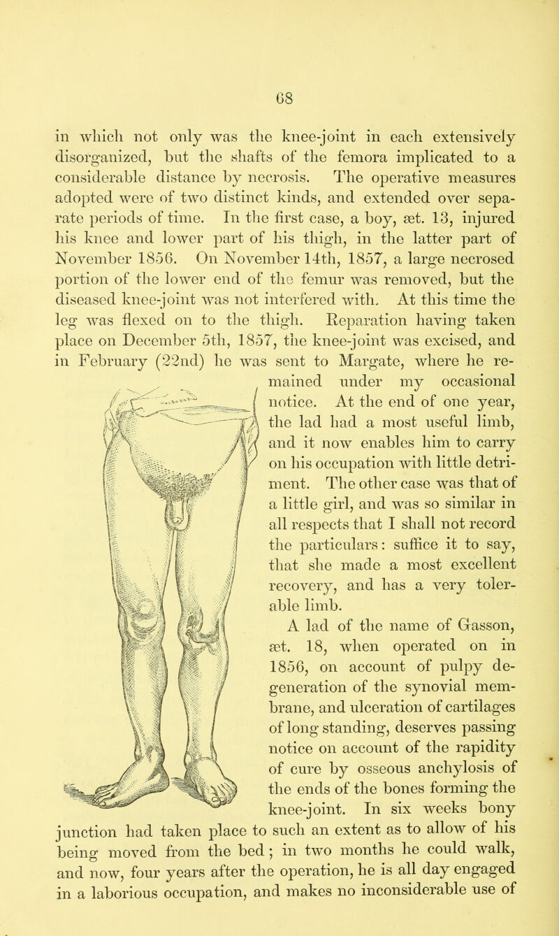 in which not only was the knee-joint in each extensively disorganized, but the shafts of the femora implicated to a considerable distance by necrosis. The operative measures adopted were of two distinct kinds, and extended over sepa- rate periods of time. In the first case, a boy, set. 13, injured his knee and lower part of his thigh, in the latter part of November 1856. On November 14th, 1857, a large necrosed portion of the lower end of the femur was removed, but the diseased knee-joint was not interfered with. At this time the leg was flexed on to the thigh. Reparation having taken place on December 5th, 1857, the knee-joint was excised, and in February (22nd) he was sent to Margate, where he re- mained under my occasional notice. At the end of one year, the lad had a most useful limb, and it now enables him to carry on his occupation with little detri- ment. The other case was that of a little girl, and was so similar in all respects that I shall not record the particulars: suffice it to say, that she made a most excellent recovery, and has a very toler- able limb. A lad of the name of Gasson, set. 18, when operated on in 1856, on account of pnlpy de- generation of the synovial mem- brane, and ulceration of cartilages of long standing, deserves passing notice on account of the rapidity of cure by osseous anchylosis of the ends of the bones forming the knee-joint. In six weeks bony junction had taken place to such an extent as to allow of his being moved from the bed; in two months he could walk, and now, four years after the operation, he is all day engaged in a laborious occupation, and makes no inconsiderable use of