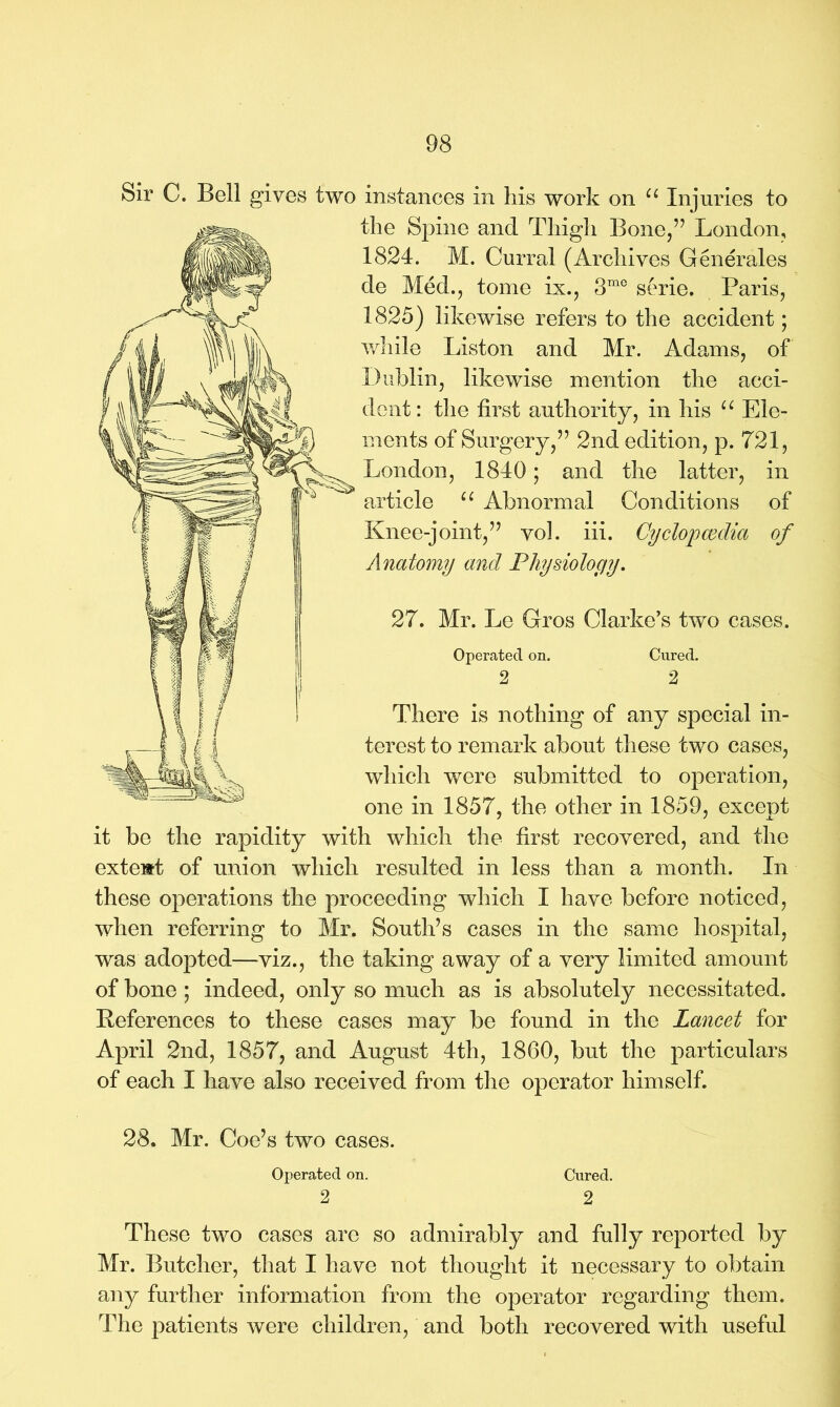 Sir C. Bell gives two instances in his work on u Injuries to the Spine and Thigh Bone,” London, 1824. M. Curral (Archives Generales de Med., tome ix., 3me serie. Paris, 1825) likewise refers to the accident; while Liston and Mr. Adams, of Dublin, likewise mention the acci- dent: the first authority, in his u Ele- ments of Surgery,” 2nd edition, p. 721, London, 1840; and the latter, in article u Abnormal Conditions of Knee-joint,” vol. iii. Cyclopaedia of Anatomy and Physiology. 27. Mr. Le Gros Clarke's two cases. Operated on. Cured. 2 2 There is nothing of any special in- terest to remark about these two cases, which were submitted to operation, one in 1857, the other in 1859, except it be the rapidity with which the first recovered, and the extent of union which resulted in less than a month. In these operations the proceeding which I have before noticed, when referring to Mr. South’s cases in the same hospital, was adopted—viz., the taking away of a very limited amount of bone ; indeed, only so much as is absolutely necessitated. References to these cases may be found in the Lancet for April 2nd, 1857, and August 4th, 1860, but the particulars of each I have also received from the operator himself. 28. Mr. Coe’s two cases. Operated on. Cured. 2 2 These two cases are so admirably and fully reported by Mr. Butcher, that I have not thought it necessary to obtain any further information from the operator regarding them. The patients were children, and both recovered with useful