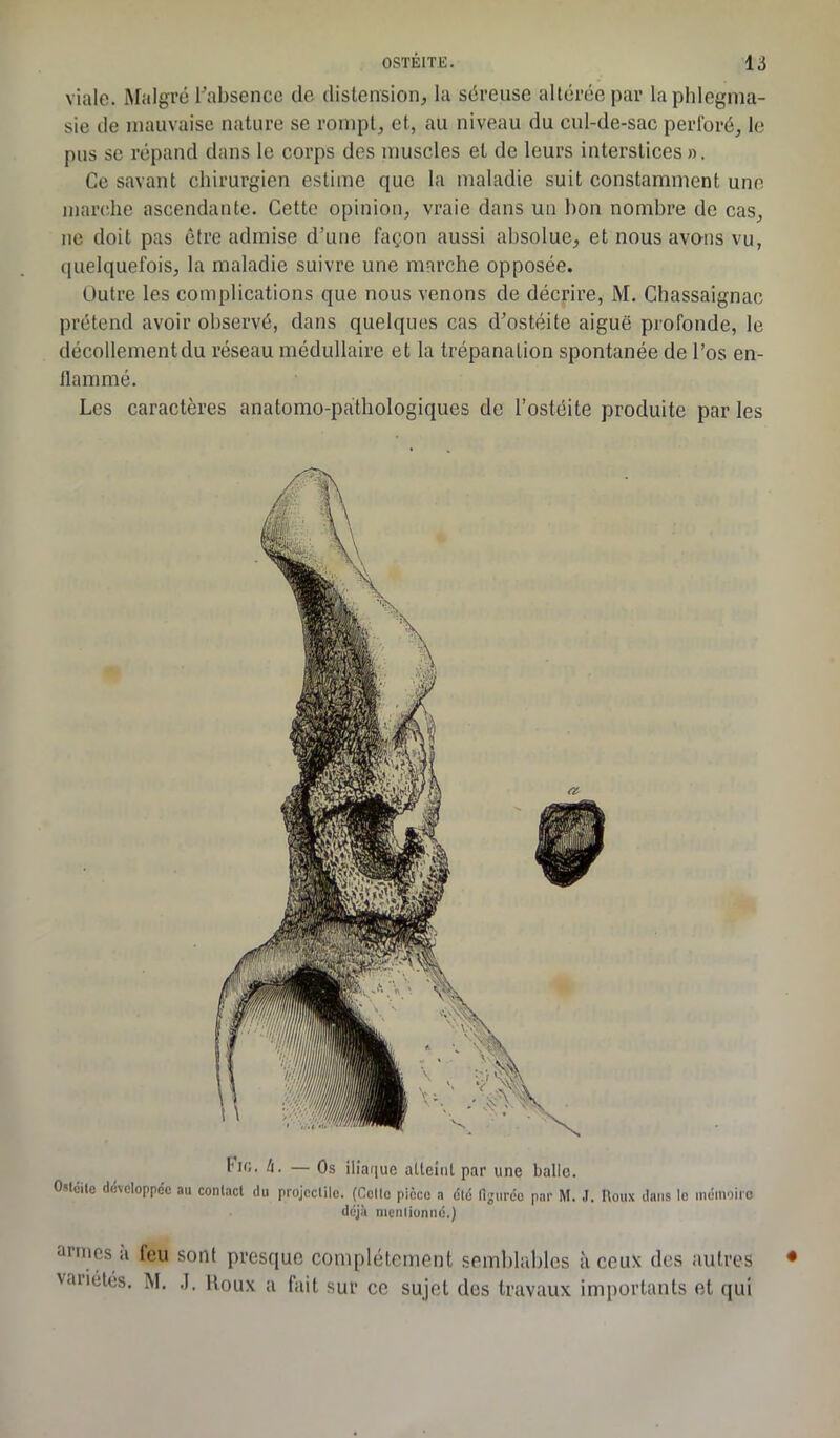 viale. Malgré l'absence de distension, la séreuse altérée par laphlegma- sie de mauvaise nature se rompt, et, au niveau du cul-de-sac perforé, le pus se répand dans le corps des muscles et de leurs interstices ». Ce savant chirurgien estime que la maladie suit constamment une marche ascendante. Cette opinion, vraie dans un bon nombre de cas, ne doit pas être admise d’une façon aussi absolue, et nous avons vu, quelquefois, la maladie suivre une marche opposée. Outre les complications que nous venons de décrire, M. Chassaignae prétend avoir observé, dans quelques cas d’ostéite aiguë profonde, le décollementdu réseau médullaire et la trépanation spontanée de l’os en- 11 animé. Les caractères anatomo-pathologiques de l’ostéite produite par les tic. h. — Os iliaque atteint par une balle. OMcile développée au conlact du projectile. (Colle picco a été figurée par M. J. Houx dans le mémoire déjà mentionné.) armes a feu sont presque complètement semblables à ceux des autres vauétés. M. J. Houx a fait sur ce sujet dos travaux importants et qui