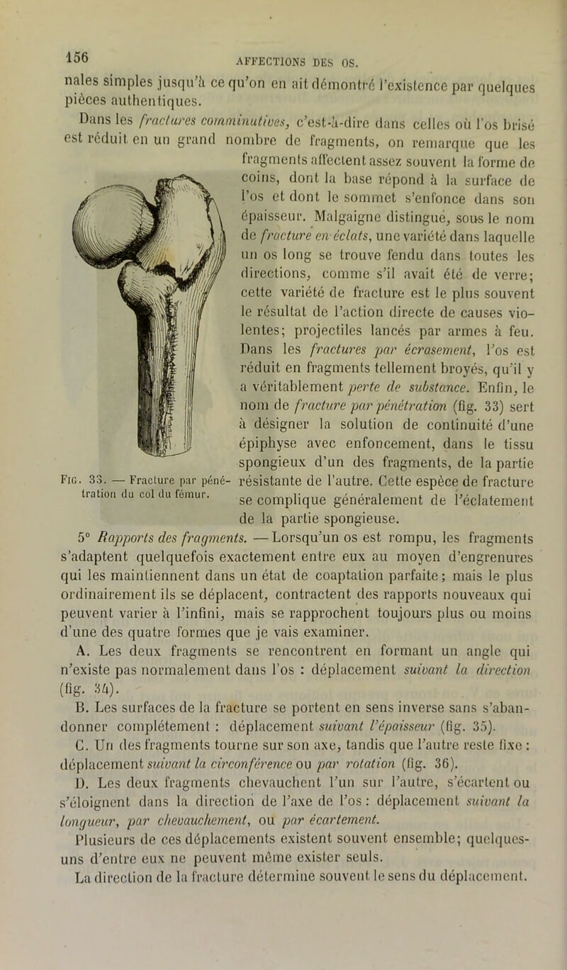 nales simples jusqu'à ce qu’on en ait démontré l’existence par quelques pièces authentiques. Dans les fractures comminutfBôs, c’est-à-dire dans celles où l’os brisé est réduit en un grand nombre de fragments, on remarque que les fragments affectent assez souvent la forme de coins, dont la base répond à la surface de l’os et dont le sommet s’enfonce dans son épaisseur. Malgaigne distingué, sous le nom de fracture an éclats, une variété dans laquelle un os long se trouve fendu dans toutes les directions, comme s’il avait été de verre; cette variété de fracture est le plus souvent le résultat de l’action directe de causes vio- lentes; projectiles lancés par armes à feu. Dans les fractures par écrasement, l’os est réduit en fragments tellement broyés, qu’il y a véritablement perte de substance. Enfin, le nom de fracture par pénétration (fig. 33) sert à désigner la solution de continuité d’une épiphyse avec enfoncement, dans le tissu spongieux d’un des fragments, de la partie résistante de l’autre. Cette espèce de fracture se complique généralement de l’éclatement de la partie spongieuse. 5° Rapports des fragments. —Lorsqu’un os est rompu, les fragments s’adaptent quelquefois exactement entre eux au moyen d’engrenures qui les maintiennent dans un état de coaptation parfaite; mais le plus ordinairement ils se déplacent, contractent des rapports nouveaux qui peuvent varier à l’infini, mais se rapprochent toujours plus ou moins d’une des quatre formes que je vais examiner. A. Les deux fragments se rencontrent en formant un angle qui n’existe pas normalement dans l’os : déplacement suivant la direction (fig. 3U). B. Les surfaces de la fracture se portent en sens inverse sans s’aban- donner complètement : déplacement suivant l’épaisseur (fig. 35). C. Un des fragments tourne sur son axe, tandis que l’autre reste fixe : déplacement suivant la circonférence ou par rotation (fig. 36). D. Les deux fragments chevauchent l’un sur l’autre, s’écartent ou s’éloignent dans la direction de l’axe de l’os : déplacement suivant la longueur, par chevauchement, ou par écartement. Plusieurs de ces déplacements existent souvent ensemble; quelques- uns d’entre eux ne peuvent même exister seuls. La direction de la fracture détermine souvent le sens du déplacement. Fig. 33. — Fracture par péné Iration du col du fémur.