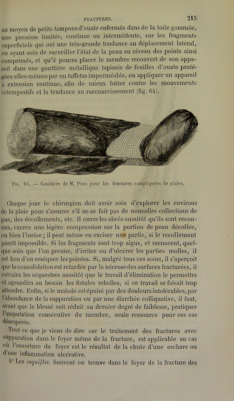 au moyen de petits tampons d’ouate enfermés dans de la toile gommée, une pression limitée, continue ou intermittente, sur les fragments superficiels qui ont une très-grande tendance au déplacement latéral, en ayant soin de surveiller l’état de la peau au niveau des points ainsi comprimés, et qu’il pourra placer le membre recouvert de son appa- reil dans une gouttière métallique tapissée de feuilles d’ouate proté- gées elles-mêmes par un taffetas imperméable, ou appliquer un appareil à extension continue, afin de mieux lutter contre les mouvements intempestifs et la tendance au raccourcissement (fig. 64). Chaque jour le chirurgien doit avoir soin d’explorer les environs de la plaie pour s’assurer s’il ne se fait pas de nouvelles collections de pus, des décollements, etc. Il ouvre les abcès aussitôt qu’ils sont recon- nus, exerce une légère compression sur la portion de peau décollée, ou bien l’incise ; il peut môme en exciser une partie, si le recollement paraît impossible. Si les fragments sont trop aigus, et menacent, quel- que soin que l’on prenne, d’irriter ou d’ulcérer les parties molles, il est bon d’en réséquer les pointes. Si, malgré tous ces soins, il s’aperçoit que la consolidation est retardée par la nécrose des surfaces fracturées, il extraira les séquestres aussitôt que le travail d’élimination le permettra et agrandira au besoin les fistules rebelles, si ce travail se faisait trop attendre. Enfin, si le malade est épuisé par des douleurs intolérables, par l’abondance de la suppuration ou par une diarrhée colliquative, il faut, avant que le blessé soit réduit au dernier degré de faiblesse, pratiquer l’amputation consécutive du membre, seule ressource pour ces cas désespérés. Tout ce que je viens de dire sur le traitement des fractures avec suppuration dans le foyer môme de la fracture, est applicable au cas où l’ouverture du foyer est le résultat de la chute d’une eschare ou d’une inflammation ulcérative. Les esquilles. Souvent on trouve dans le loyer de la fracture des