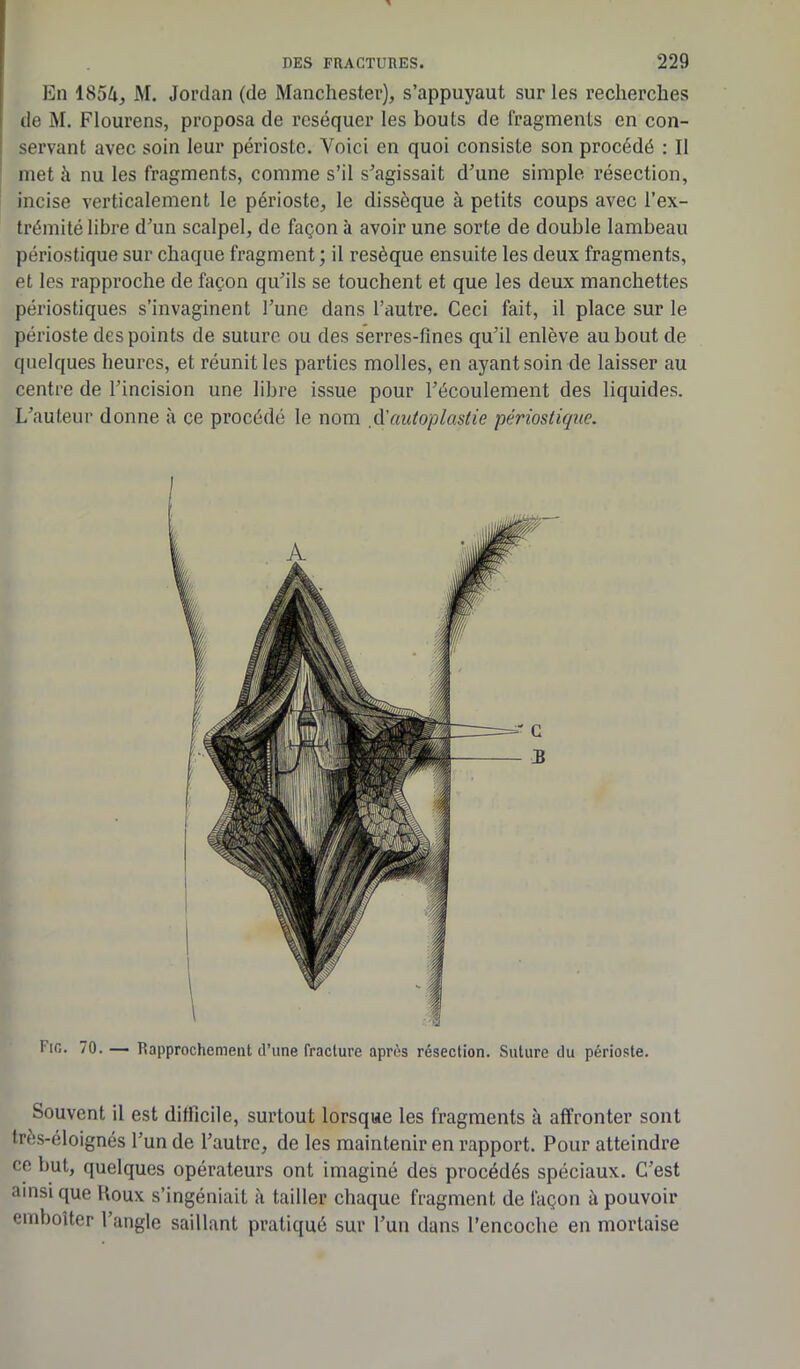 En 1854, M. Jordan (de Manchester), s’appuyaut sur les recherches de M. Flourens, proposa de réséquer les bouts de fragments en con- servant avec soin leur périoste. Voici en quoi consiste son procédé : Il met à nu les fragments, comme s’il s'agissait d'une simple résection, incise verticalement le périoste, le dissèque à petits coups avec l’ex- trémité libre d'un scalpel, de façon à avoir une sorte de double lambeau périostique sur chaque fragment ; il réséqué ensuite les deux fragments, et les rapproche de façon qu'ils se touchent et que les deux manchettes périostiques s’invaginent l’une dans l’autre. Ceci fait, il place sur le périoste des points de suture ou des serres-fines qu’il enlève au bout de quelques heures, et réunit les parties molles, en ayant soin de laisser au centre de l’incision une libre issue pour l’écoulement des liquides. L'auteur donne à ce procédé le nom d'autoplastie périostique. Souvent il est difficile, surtout lorsque les fragments à affronter sont très-éloignés l’un de l’autre, de les maintenir en rapport. Pour atteindre ce but, quelques opérateurs ont imaginé des procédés spéciaux. C’est ainsique Roux s’ingéniait à tailler chaque fragment de façon à pouvoir emboîter l’angle saillant pratiqué sur l’un dans l’encoche en mortaise