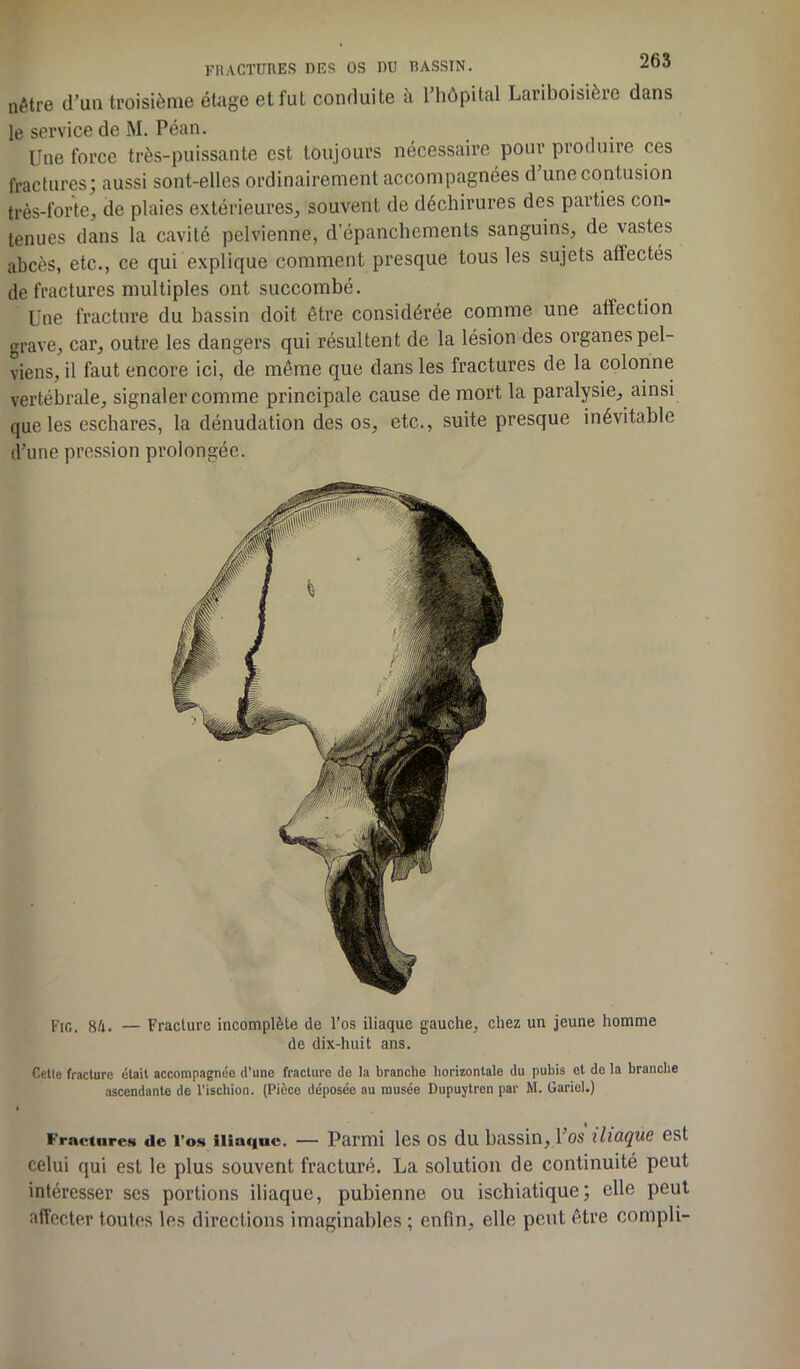 nêtre d’un troisième étage et fut conduite a 1 hôpital Lariboisière dans le service de M. Péan. Une force très-puissante est toujours nécessaire pour produire ces fractures; aussi sont-elles ordinairement accompagnées d’une contusion très-forte, de plaies extérieures, souvent de déchirures des parties con- tenues dans la cavité pelvienne, d’épanchements sanguins, de vastes abcès, etc., ce qui explique comment presque tous les sujets atlectés de fractures multiples ont succombé. Une fracture du bassin doit, être considérée comme une affection grave, car, outre les dangers qui résultent de la lésion des organes pel- viens, il faut encore ici, de même que dans les fractures de la colonne vertébrale, signaler comme principale cause de mort la paralysie, ainsi que les eschares, la dénudation des os, etc., suite presque inévitable d’une pression prolongée. Fig. g/,. — Fracture incomplète de l’os iliaque gauche, chez un jeune homme de dix-huit ans. Celle fracture était accompagnée d’une fracture de la branche horizontale du pubis et de la branche ascendante de l’ischion. (Pièce déposée au musée Dupuytren par M. Gariel.) Fractures de l’os iliaque. — Parmi les os du bassin, 1 os iliaque est celui qui est le plus souvent fracturé. La solution de continuité peut intéresser ses portions iliaque, pubienne ou ischiatique; elle peut affecter toutes les directions imaginables ; enfin, elle peut être compli-