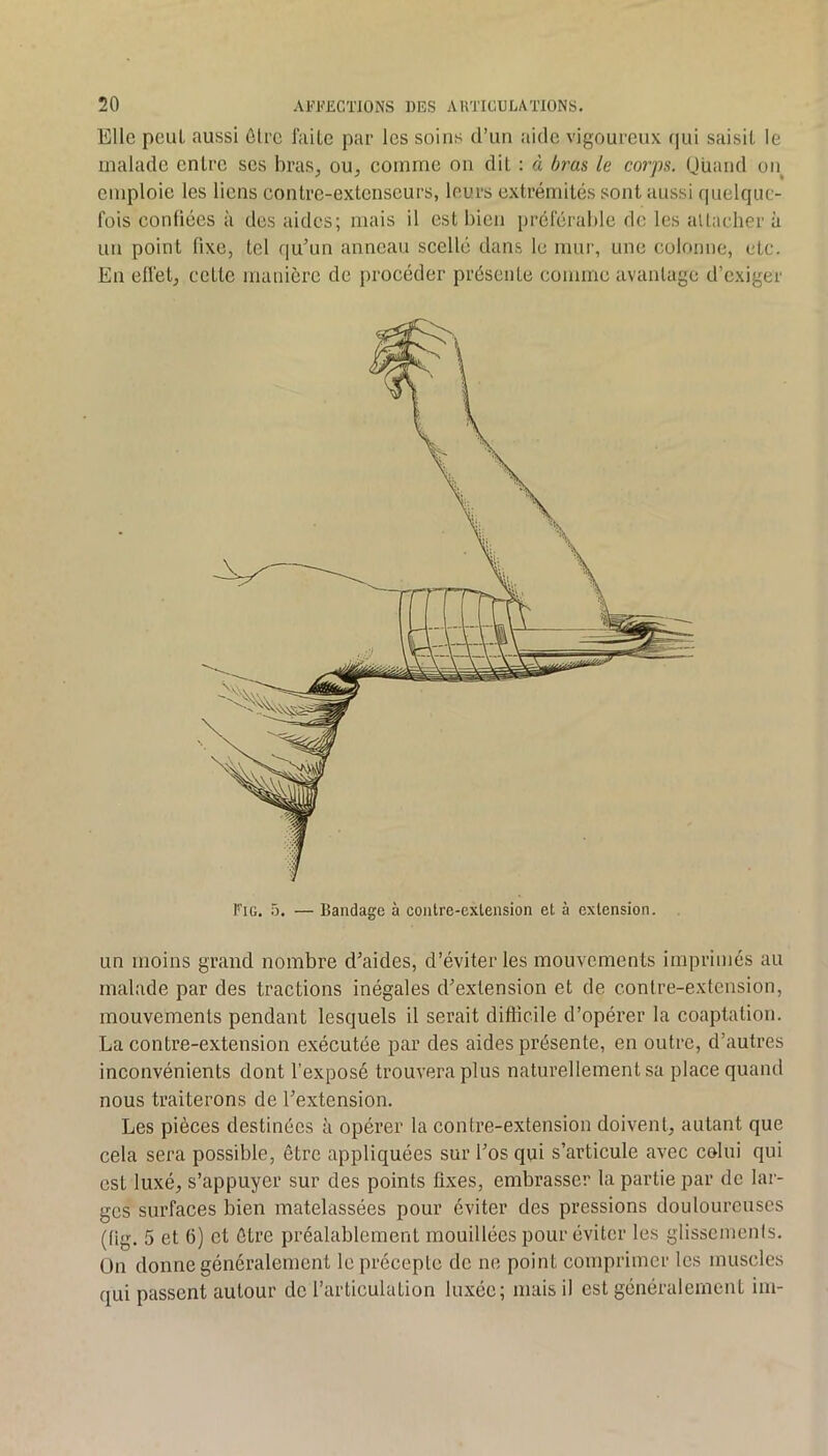 Elle peut aussi ôlrc faite par les soins d’un aide vigoureux (|ui saisit le malade entre ses bras^ ou^ comme on dit : à bras le corps. Quand on^ emploie les liens contre-extenseurs, leurs extrémités sont aussi quelque- fois confiées à des aides; mais il est bien préférable de les allacber à un point fixe, tel qu’un anneau scellé dans le mur, une colonne, etc. En effet, cette manière de procéder présente comme avantage d’exiger Fig. Tj. — Bandage à contre-exlension et à extension. un moins grand nombre d’aides, d’éviter les mouvements imprimés au malade par des tractions inégales d’extension et de contre-extension, mouvements pendant lesquels il serait difficile d’opérer la coaptation. La contre-extension exécutée par des aides présente, en outre, d’autres inconvénients dont l’exposé trouvera plus naturellement sa place quand nous traiterons de l’extension. Les pièces destinées à opérer la contre-extension doivent, autant que cela sera possible, être appliquées sur l’os qui s’articule avec celui qui est luxé, s’appuyer sur des points fixes, embrasser la partie par de lar- ges surfaces bien matelassées pour éviter des pressions douloureuses (fig. 5 et 6) et être préalablement mouillées pour éviter les glissements. Ün donne généralement le précepte de ne point comprimer les muscles qui passent autour de l’articulation luxée; mais il est généralement im-