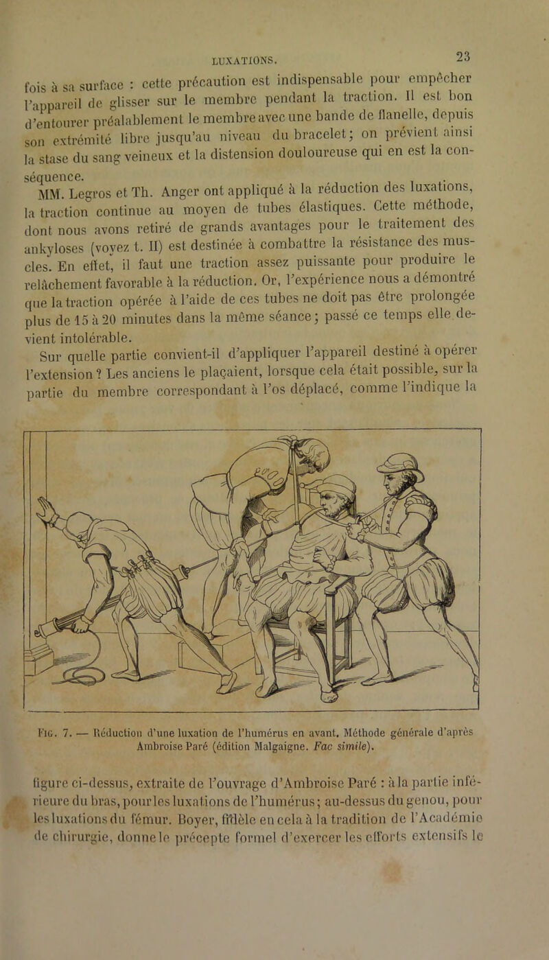 fois à sa surfoce : cette précaution est indispensable pour empêcher l’appareil de glisser sur le membre pendant la traction. Il est bon c/’entourer préalablement le membre avec une bande de flanelle, depuis son extrémité libre jusqu’au niveau du bracelet; on prévient ainsi la stase du sang veineux et la distension douloureuse qui en est la con- séquence. , . , I X- MM. Legros et Th. Anger ont appliqué à la réduction des luxations, la traction continue au moyen de tubes élastiques. Cette méthode, dont nous avons retiré de grands avantages pour le traitement des ankylosés (voyez t. II) est destinée à combattre la résistance des mus- cles. En efteC H faut une traction assez puissante pour produire le relâchement favorable à la réduction. Or, l’expérience nous a démontré que la traction opérée à l’aide de ces tubes ne doit pas être prolongée plus de 15 à20 minutes dans la même séance; passé ce temps elle de- vient intolérable. Sur quelle partie convient-il d’appliquer l’appareil destiné à opérer l’extension ? Les anciens le plaçaient, lorsque cela était possible, sur la partie du membre correspondant à l’os déplacé, comme 1 indique la Kic. 7. — liéductioii d’une luxation de l’humérus en avant. Méthode générale d’.après Ambroise Paré (édition Malgaigne. Fac simile). figure ci-dessus, extraite de l’ouvrage d’Ambroise Paré : à la partie infé- rieure du bras, pourles luxations de l’humérus ; au-dessus du genou, pour les luxations du fémur. Boyer, fitlèle en cela à la tradition de l’Académio de chirurgie, donnele jirécepte formel d’exercer les efforts extensifs le