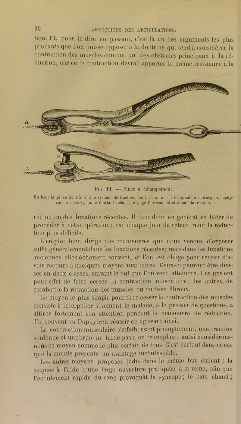 tion. Et, pour le dire en passant, c’est là un des arguments les plus probants que l’on puisse opposera la doctrine qui tend à considérer la contraction des muscles comme un des obstacles principaux à la ré- duction;, car cette contraction devrait apporter la même résistance à la Fig. 11. — Pince à échappement. En haut la pinco tient à tout le système de traction; en bas, on a, sur le signal du chirurgien, appuyé sur le ressort, qui à l'instant même a dégagé l’instrument et annulé la traction. réduction des luxations récentes. Il faut donc en général se hâter de procéder à cette opération; car chaque jour de retard rend la réduc- tion plus difficile. L’emploi bien dirigé des manœuvres que nous venons d’exposer SLitfit généralement dans les luxations récentes; mais dans les luxations anciennes elles échouent souvent, et l’on est obligé pour réussir d’a- voir recours à quelques moyens auxiliaires. Ceux-ci peuvent être divi- sés en deux classes, suivant le but que l’on veut atteindre. Les uns ont pour efl’et de faire cesser la contraction musculaire ; les autres, de combattre la rétraction des muscles ou du tissu fibreux. Le moyen le plus simple pour faire cesser la contraction des muscles consiste à interpeller vivement le malade, à le presser de questions, à attirer fortement son attention pendant la manœuvre de réduction. J’ai souvent vu Dupuytren réussir en agissant ainsi. La contraction musculaire s’affaiblissant promptement, une traction soutenue et uniforme ne tarde pas à en triompher : aussi considérons- nous ce moyen comme le plus certain de tous. C’est surtout dans ce cas que la mouffe présente un avantage incbntestable. Les autres moyens proposés jadis dans le môme but étaient : la saignée à l’aide d’une large ouverture pratiquée à la veine, afin que l’écoulement rapide du sang provoquât la syncope; le bain chaud;