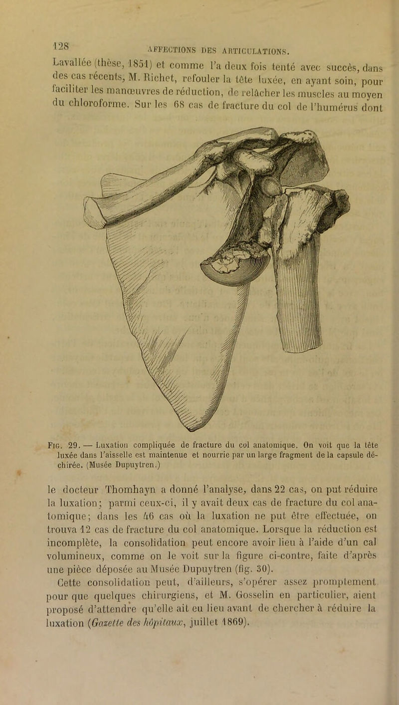 Lavallée (thèse, ]851) et comme La deux fois tenté avec succès, dans des cas récents, M. Richet, refouler la tète luxée, en ayant soin, pour faciliter les manœuvres de réduction, de relâcher les muscles au moyen du chloroforme. Sur les 68 cas de fracture du col de l’humérus dont Fig. 29. — Luxation compliquée de fracture du col anatomique. On voit que la tête luxée dans l’aisselle est maintenue et nourrie par un large fragment de la capsule dé- chirée. (Musée Dupuytren.) le docteur Thomhayn a donné l’analyse, dans 22 cas, on put réduire la luxation; parmi ceux-ci, il y avait deux cas de fracture du col ana- tomique; dans les 46 cas où la luxation ne put être elfectuée, on trouva 12 cas de fracture du col anatomique. Lorsque la réduction est incomplète, la consolidation peut encore avoir lieu à Laide d’un cal volumineux, comme on le voit sur la figure ci-contre, faite d’après une pièce déposée au Musée Dupuytren (fig. 30). Cette consolidation peut, d’ailleurs, s’opérer assez promptement pour que quelques chirurgiens, et M. Gosselin en particulier, aient proposé d’attendre qu’elle ait eu lieu avant de chercher à réduire la luxation {Gazette des hôpitaux^ juillet 1869).