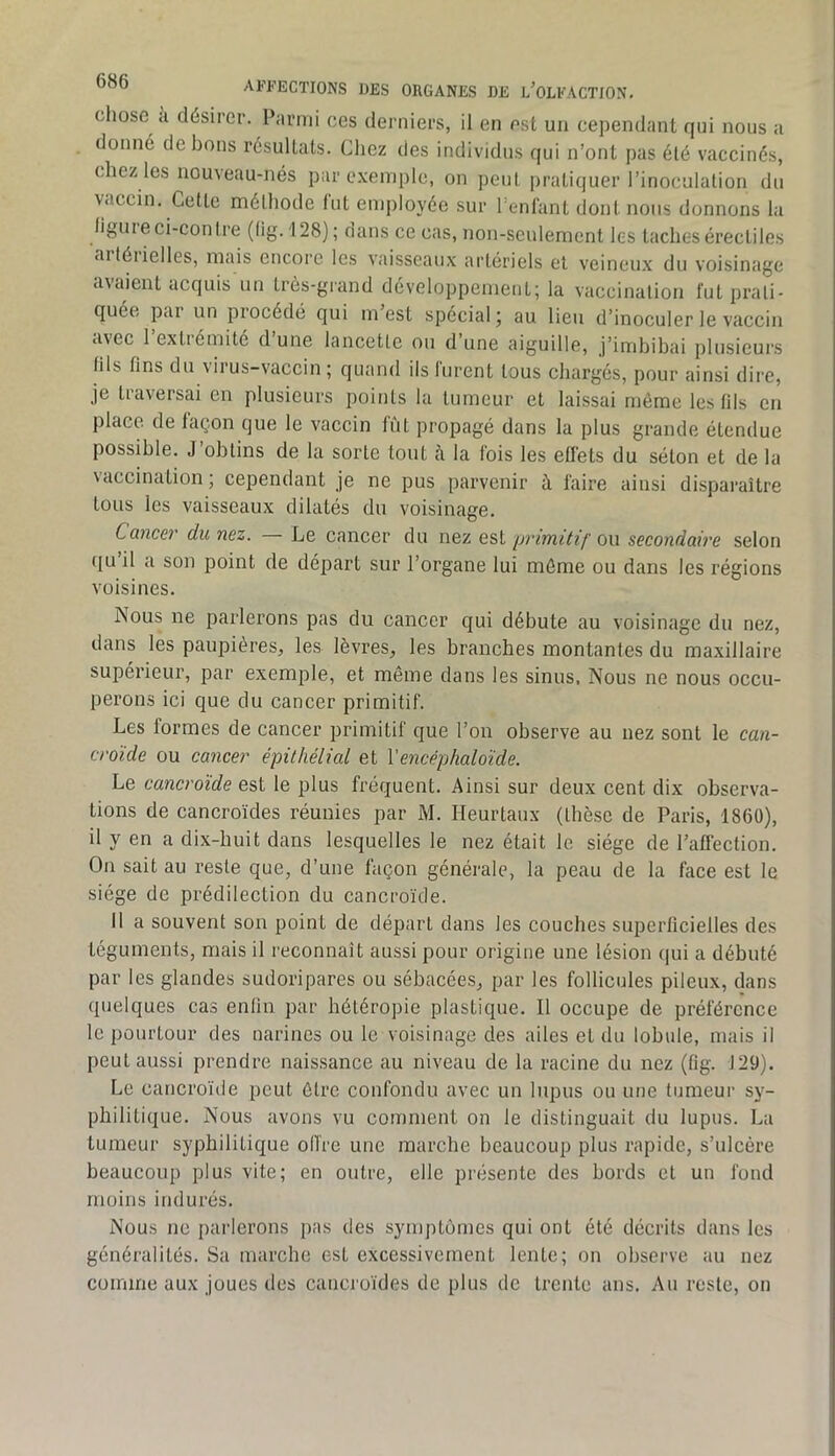chose a désirer. Parmi ces derniers, il en est un cependant rjui nous a donné de bons résultats. Chez des individus qui n’ont pas été vaccinés, chez les nouveau-nés par exemple, on peut pratiquer l’inoculation du vaccin. Cette méthode lut employée sur l’enlant dont nous donnons la figuie ci-contre (lig. 128) ; dans ce cas, non-seulement les taches érectiles aiféiielles, mais encore les vaisseaux artériels et veineux du voisinage avaient acquis un très-grand développement; la vaccination fut prati- quée pai un piocedé qui m est spécial; au lien d’inoculer le vaccin avec 1 extiémite dune lancette on d une aiguille, j’imbibai plusieurs fils fins du virus-vaccin; quand ils lurent tous chargés, pour ainsi dire, je traversai en plusieurs points la tumeur et laissai même les fils en place de façon que le vaccin fût propagé dans la plus grande étendue possible. J obtins de la sorte tout à la fois les effets du séton et de la vaccination; cependant je ne pus parvenir à faire ainsi dispai-aître tous les vaisseaux dilatés du voisinage. Cancer du nez. Le cancer du nez est primitif ou secondaire selon qu il a son point de départ sur l’organe lui môme ou dans les régions voisines. Nous ne parlerons pas du cancer qui débute au voisinage du nez, dans les paupières, les lèvres, les branches montantes du maxillaire supérieur, par exemple, et même dans les sinus, Nous ne nous occu- perons ici que du cancer primitif. Les formes de cancer primitif que l’on observe au nez sont le can- croïde ou cancer épithélial et Vencéphaloïde. Le cancroïde est le plus fréquent. Ainsi sur deux cent dix observa- tions de cancroïdes réunies par M. Heurtaux (thèse de Paris, 1860), il y en a dix-huit dans lesquelles le nez était le siège de l’affection. On sait au reste que, d’une façon générale, la peau de la face est le siège de prédilection du cancroïde. 11 a souvent son point de départ dans les couches superficielles des téguments, mais il reconnaît aussi pour origine une lésion qui a débuté par les glandes sudoripares ou sébacées, par les follicules pileux, dans quelques cas enfin par hétéropie plastique. Il occupe de préférence le pourtour des narines ou le voisinage des ailes et du lobule, mais il peut aussi prendre naissance au niveau de la racine du nez (fig. 129). Le cancroïde peut être confondu avec un lupus ou une tumeur sy- philitique. Nous avons vu comment on le distinguait du lupus. La tumeur syphilitique oiïre une marche beaucoup plus rapide, s’ulcère beaucoup plus vite; en outre, elle présente des bords et un fond moins indurés. Nous ne parlerons pas des symptômes qui ont été décrits dans les généralités. Sa marche est excessivement lente; on observe au nez comme aux joues des cancroïdes de plus de trente ans. Au reste, on
